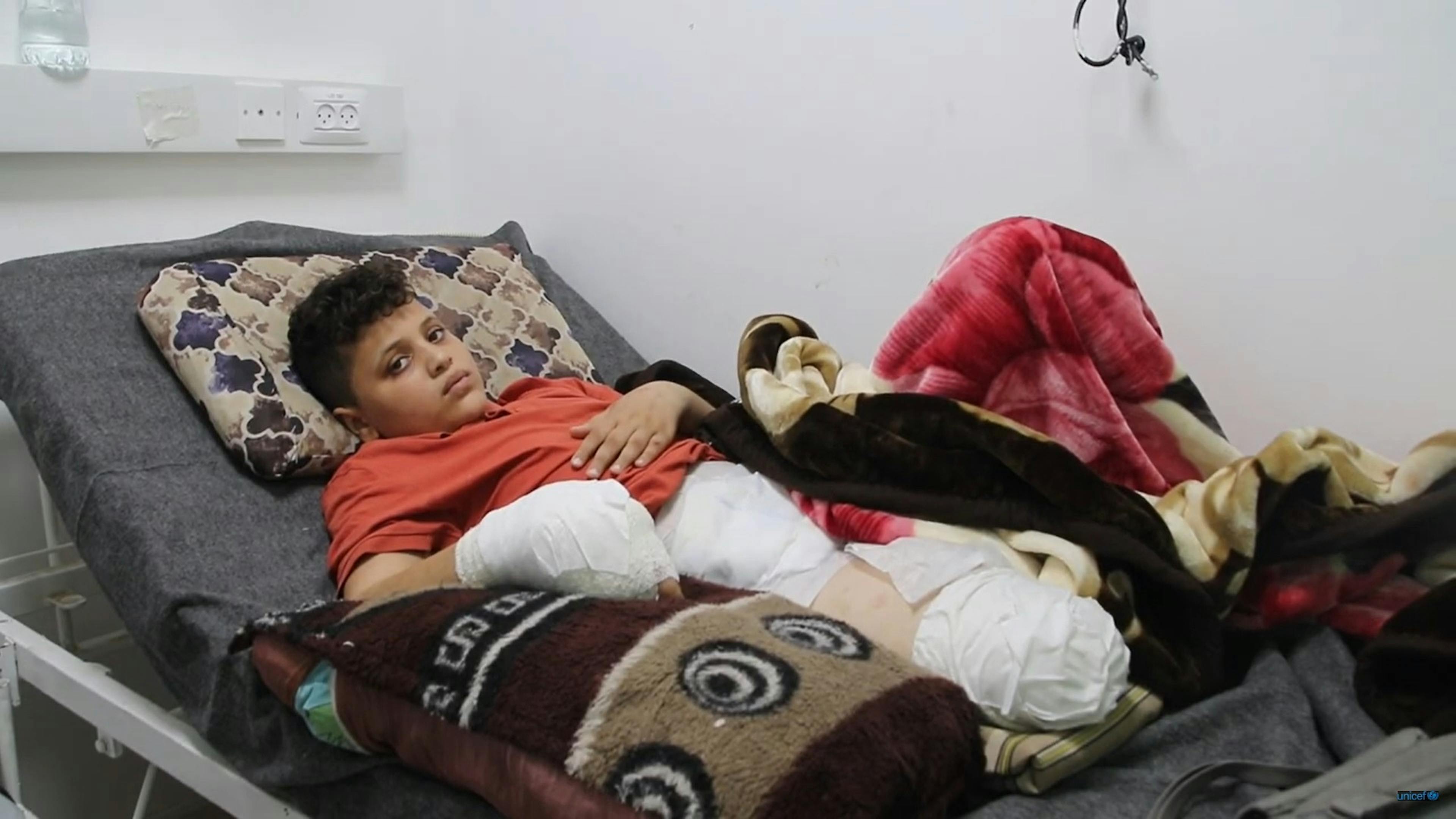 Ramadan, 11 anni – “Stavo dando da mangiare alle mie anatre e alle mie galline, e all'improvviso è stata bombardata una casa di fronte alla nostra, sono svenuto. Quando mi sono svegliato non avevo più la mia gamba. Come andrò a scuola? Come correrò? Come giocherò con i miei amici? Mi vergogno”.  I bambini di Gaza porteranno queste ferite per sempre.