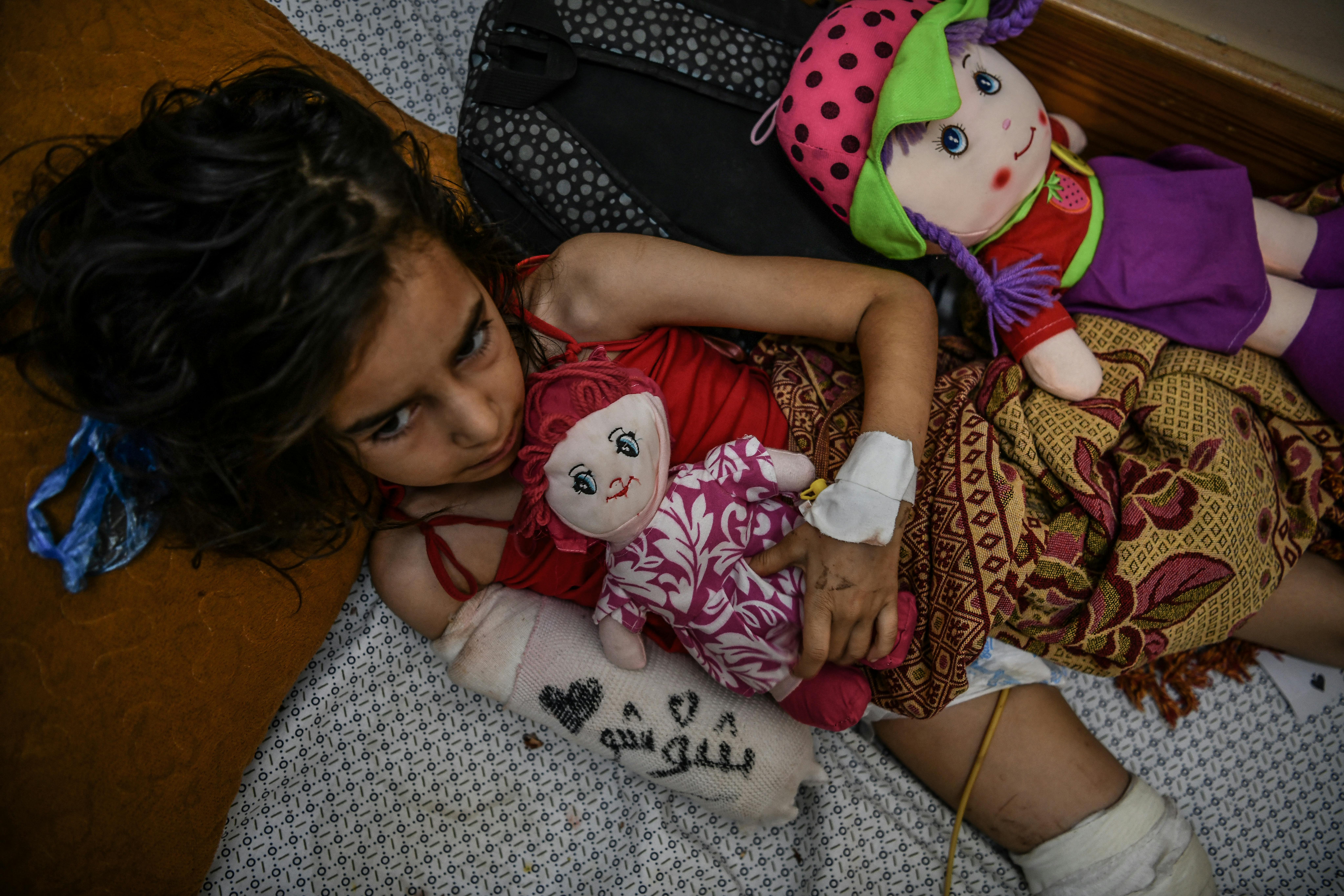Gaza chi paga il prezzo più alto della guerra sono i bambini. Migliaia sono stati feriti. Molti di loro sono mutilati.  Shaymaa, 8 anni – “Ero a casa quando è iniziato il bombardamento e stavo giocando con i miei fratelli. Mio padre era fuori a preparare il fuoco perché mia madre ci voleva cucinare la pasta. All'improvviso la casa accanto alla nostra è stata bombardata e un pezzo di metallo mi è caduto addosso, tagliandomi il braccio.