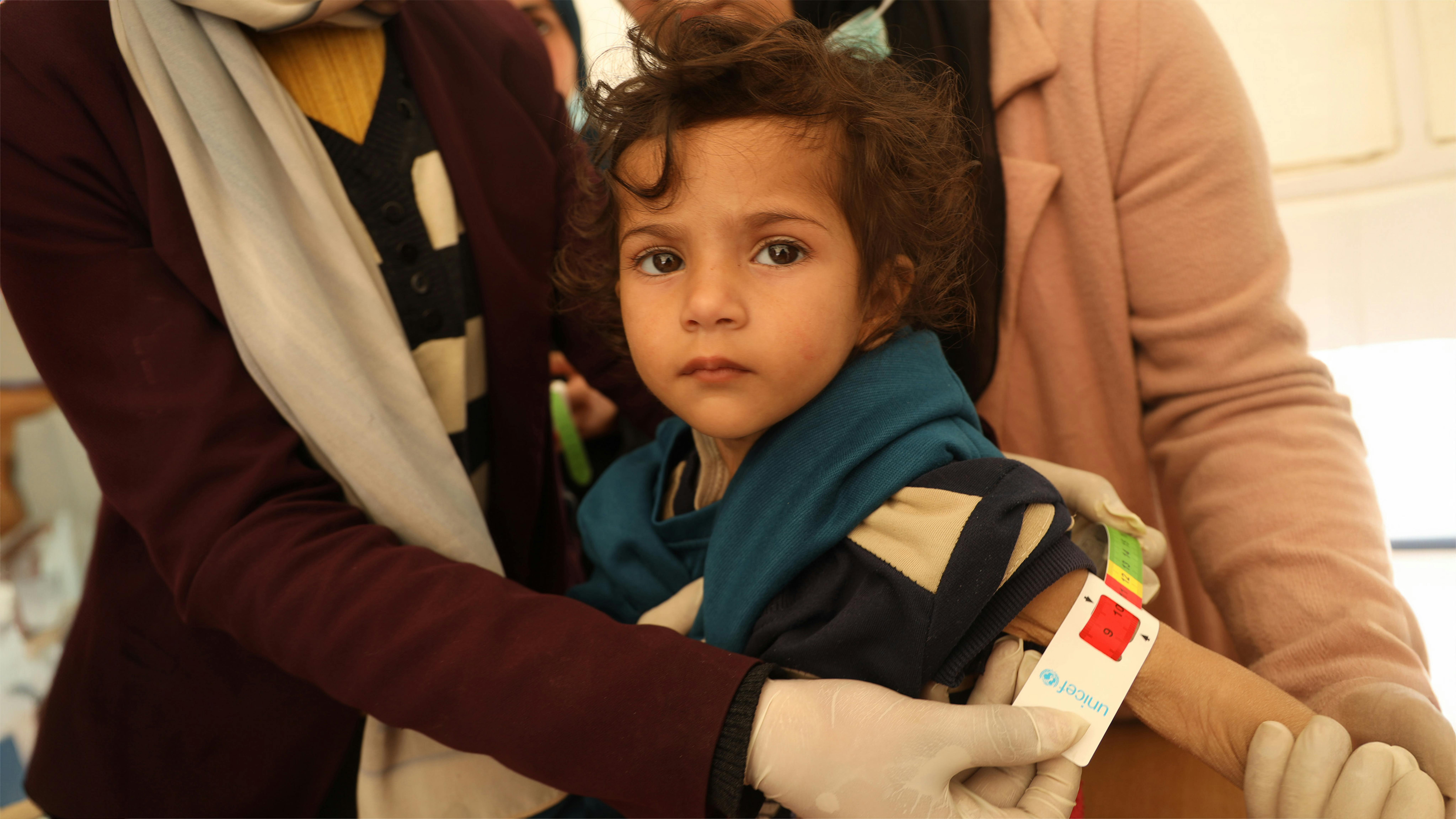 Stato di Palestina - Leen, 2 anni, si sta misurando la circonferenza del braccio medio-superiore (MUAC), il suo MUAC è inferiore a 10, indicando una grave malnutrizione acuta e un peso drastico