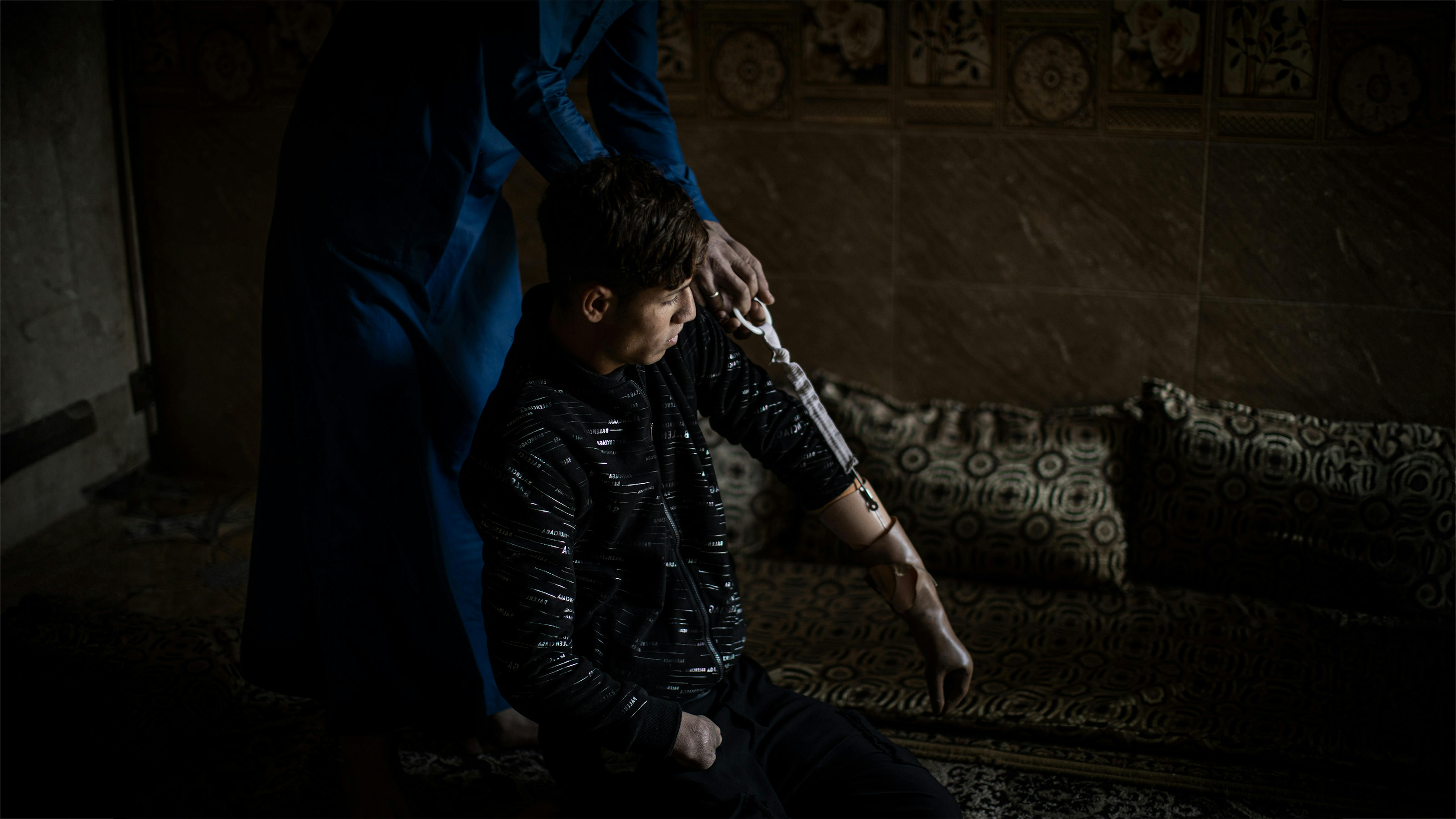 Iraq, il diciassettenne Ali viene aiutato a mettere una protesi alla mano da suo fratello Sa'ad, nella loro casa a Mesherfa, alla periferia di Mosul.