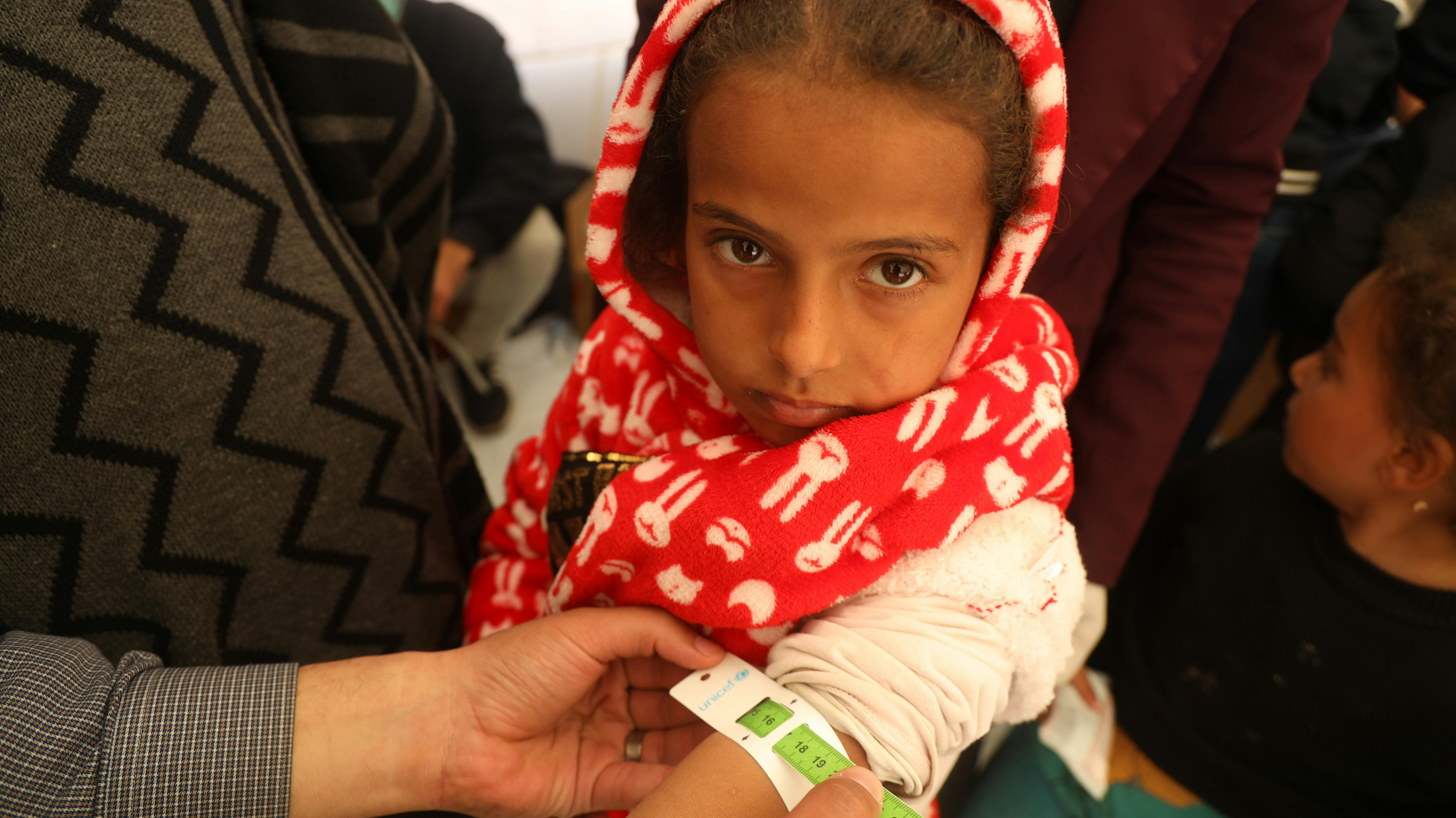 Amal, 4 anni, si sta sottoponendo alla misurazione della circonferenza medio-superiore del braccio (MUAC) come parte del suo screening per la malnutrizione presso una tenda clinica pediatrica supportata dall'UNICEF a Rafah