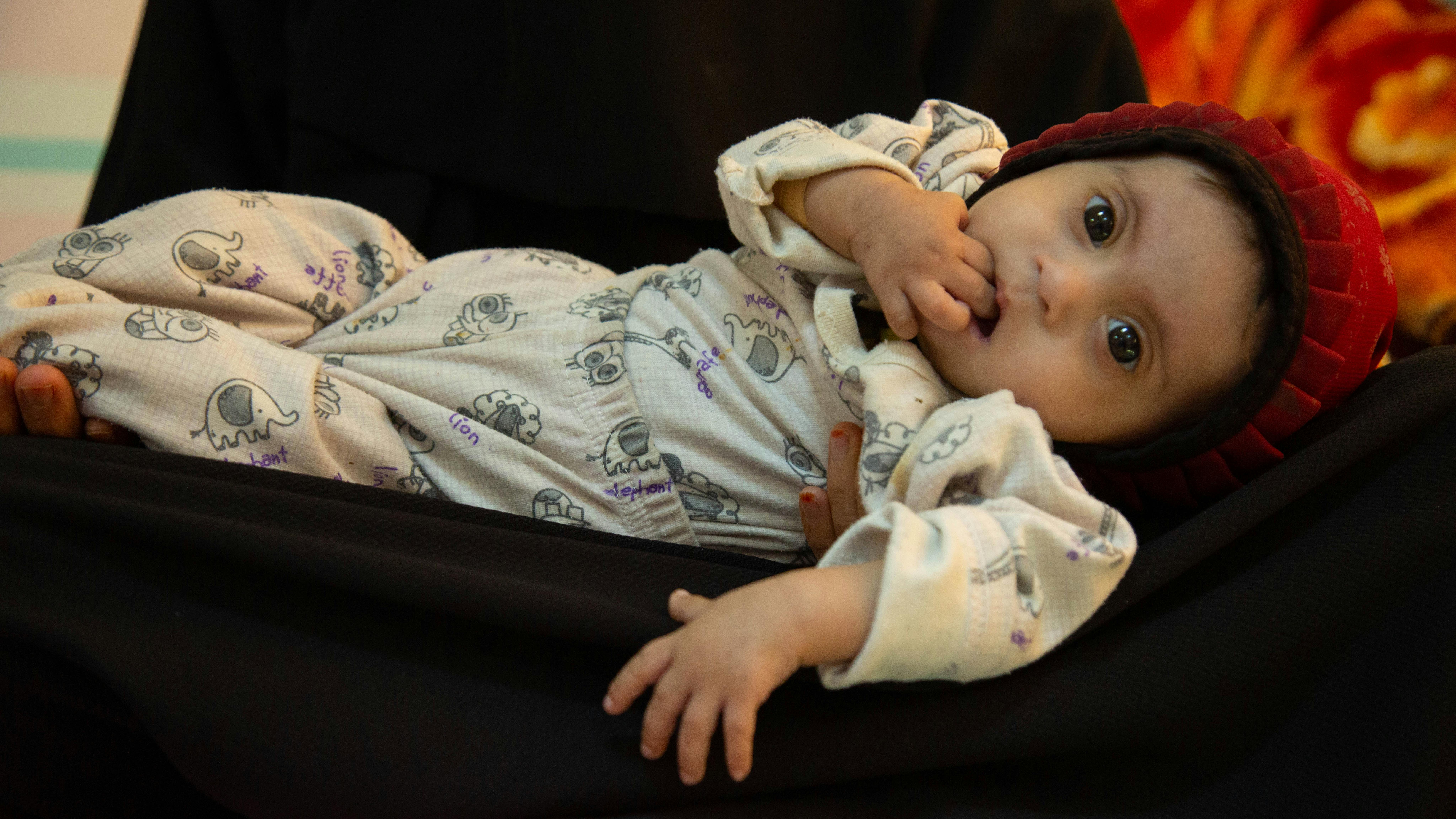 Khawla, 10 mesi, giace tra le braccia della madre nel reparto di malnutrizione del Palestine Hospital di Sana'a, nello Yemen, il 10 ottobre 2021. Khawla è stata ricoverata il 6 ottobre 2021 per malnutrizione; pesava 3,4 kg