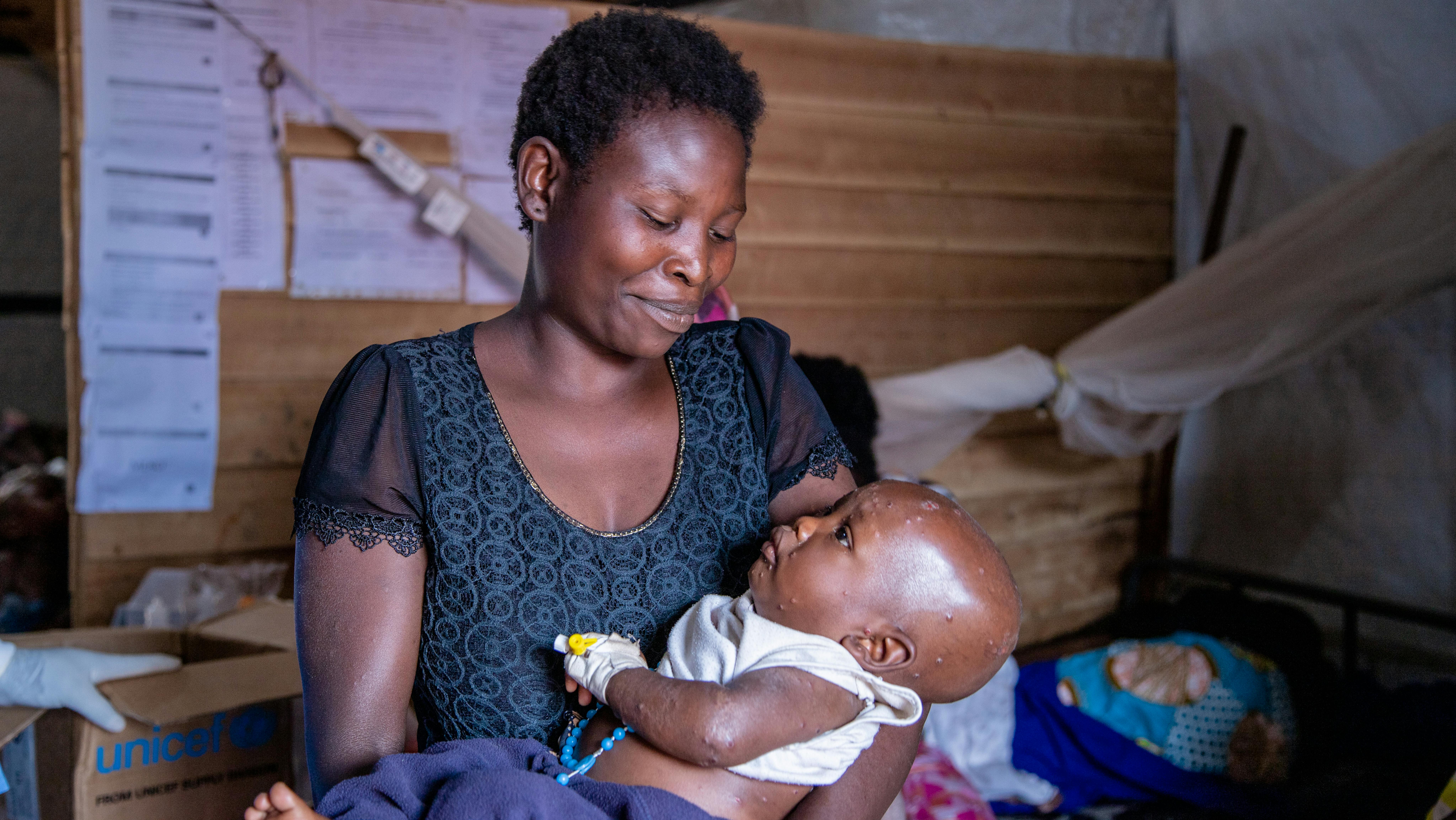 Agisha, 7 mesi, tra le braccia della madre Mapendo, presso l'unità di isolamento mpox dell'ospedale Kavumu, sostenuto dall'UNICEF, nella provincia del Sud Kivu, Repubblica Democratica del Congo