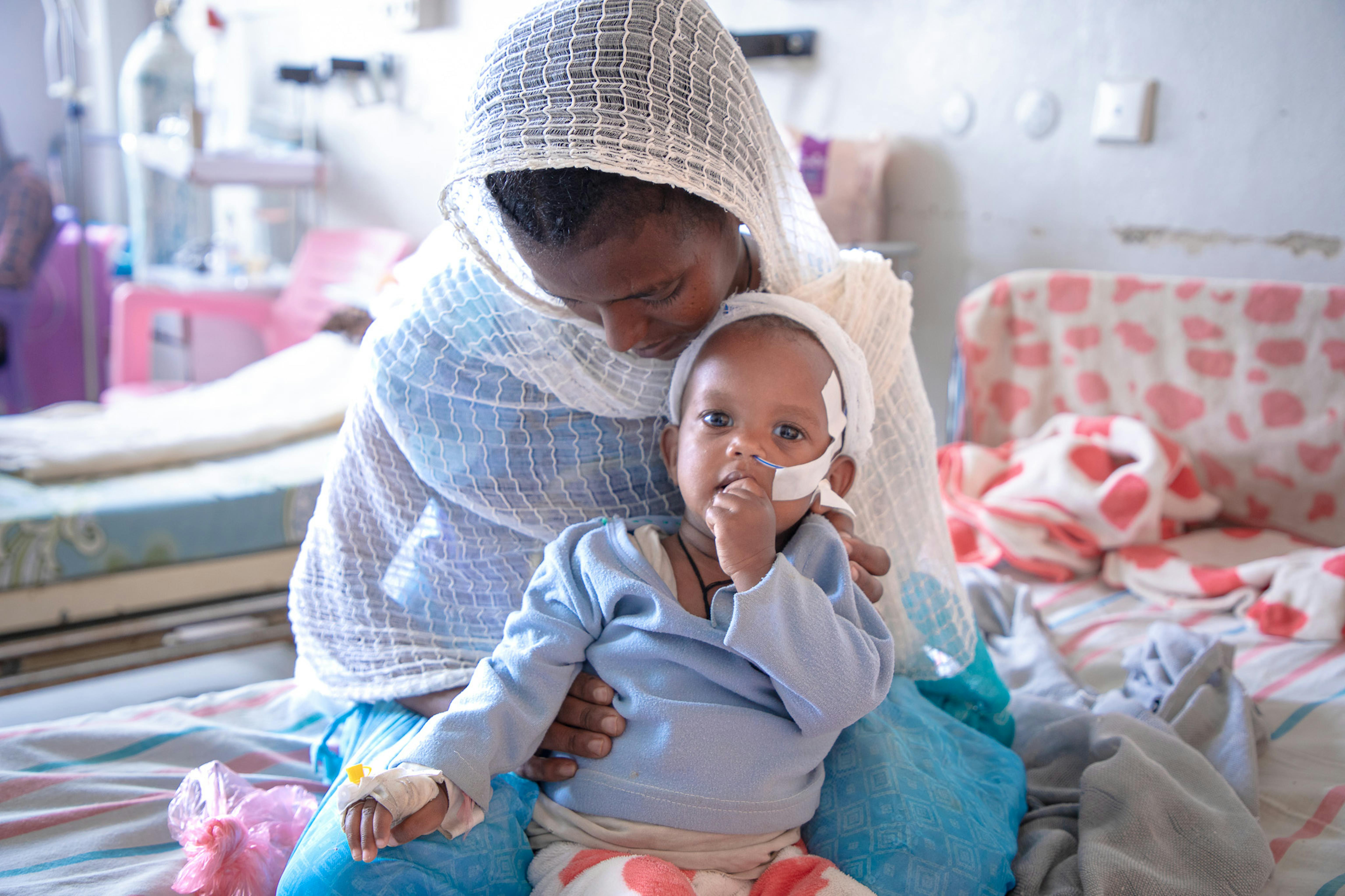 Etiopia: questa piccola di 13 mesi soffriva di malnutrizione acuta grave e per questo motivo è stata ricoverata nell'ospedale Ayder, supportato dall'UNICEF. Ora sta meglio, grazie alle cure ricevute!