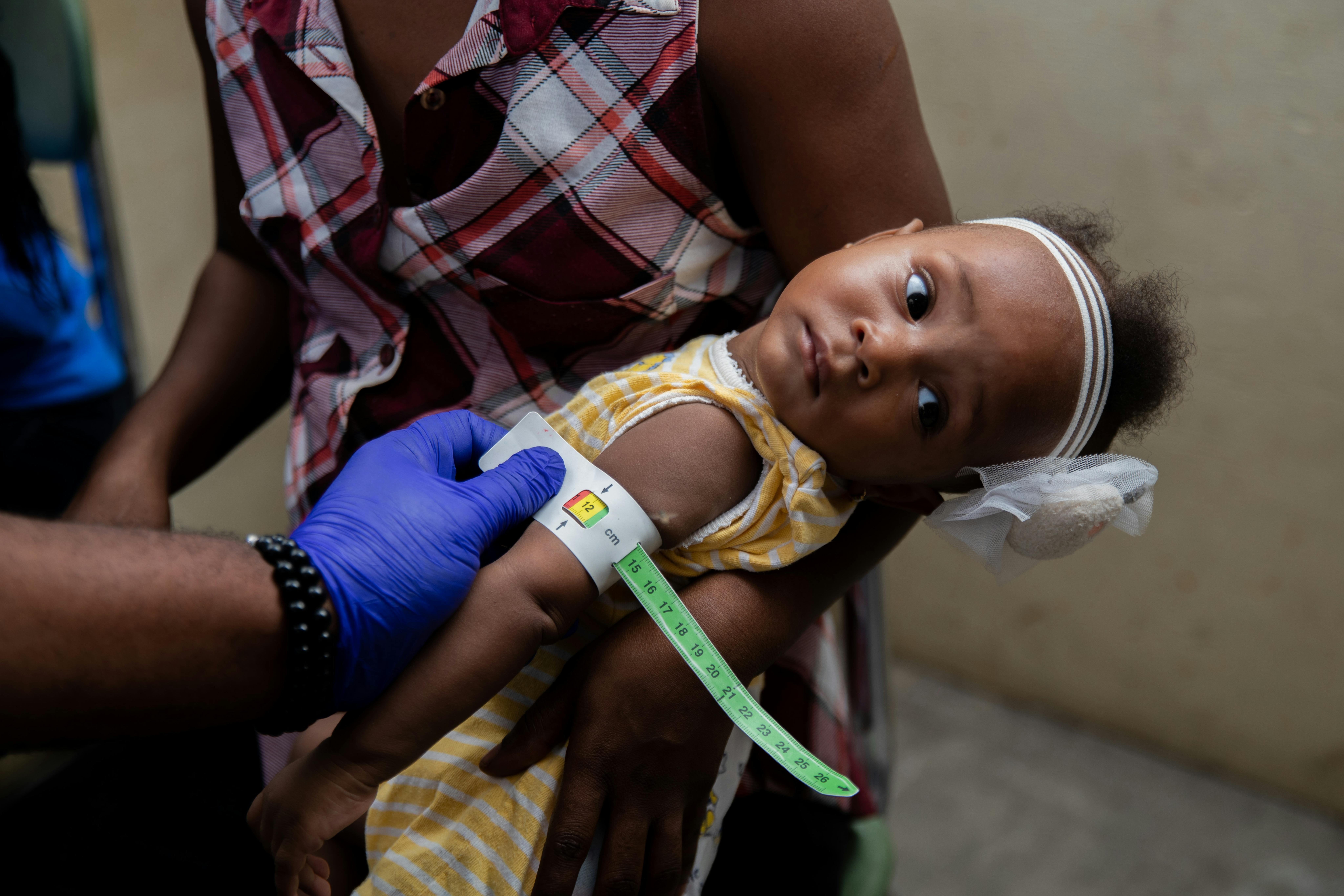 Haiti: una bambina viene visitata a Lycée des Jeunes Filles di Port-au-Prince,  durante uno screening per malnutrizione all'interno di una clinica mobile una clinica mobile organizzata dall'UNICEF con un partner