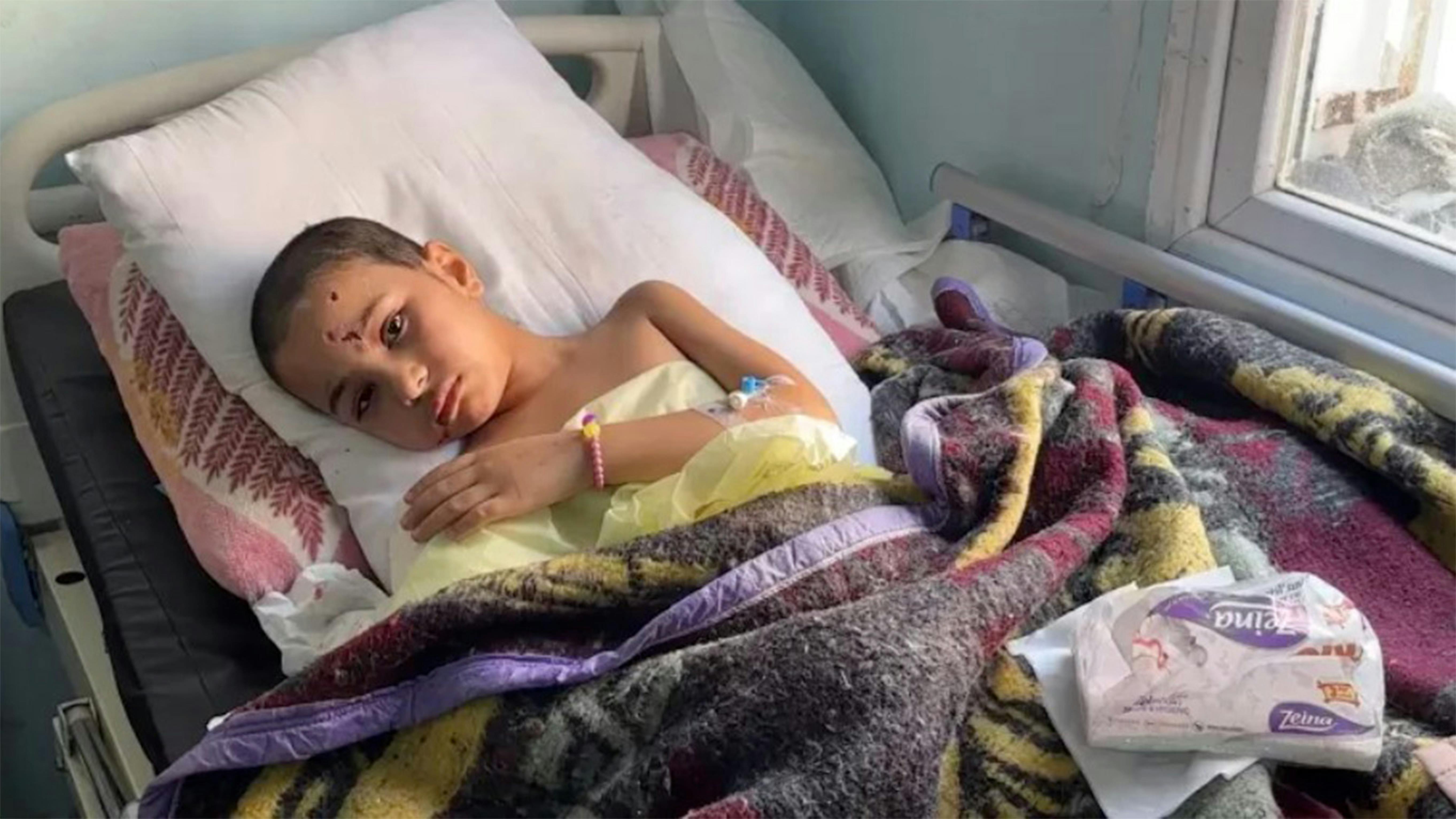 Jouri, 9 anni, all'ospedale europeo di Khan Younis, Gaza, il 9 aprile 2024. Le ossa del braccio destro, del polso e del lato destro del viso di Jouri presentavano diverse fratture, che probabilmente richiedevano un ulteriore intervento chirurgico.