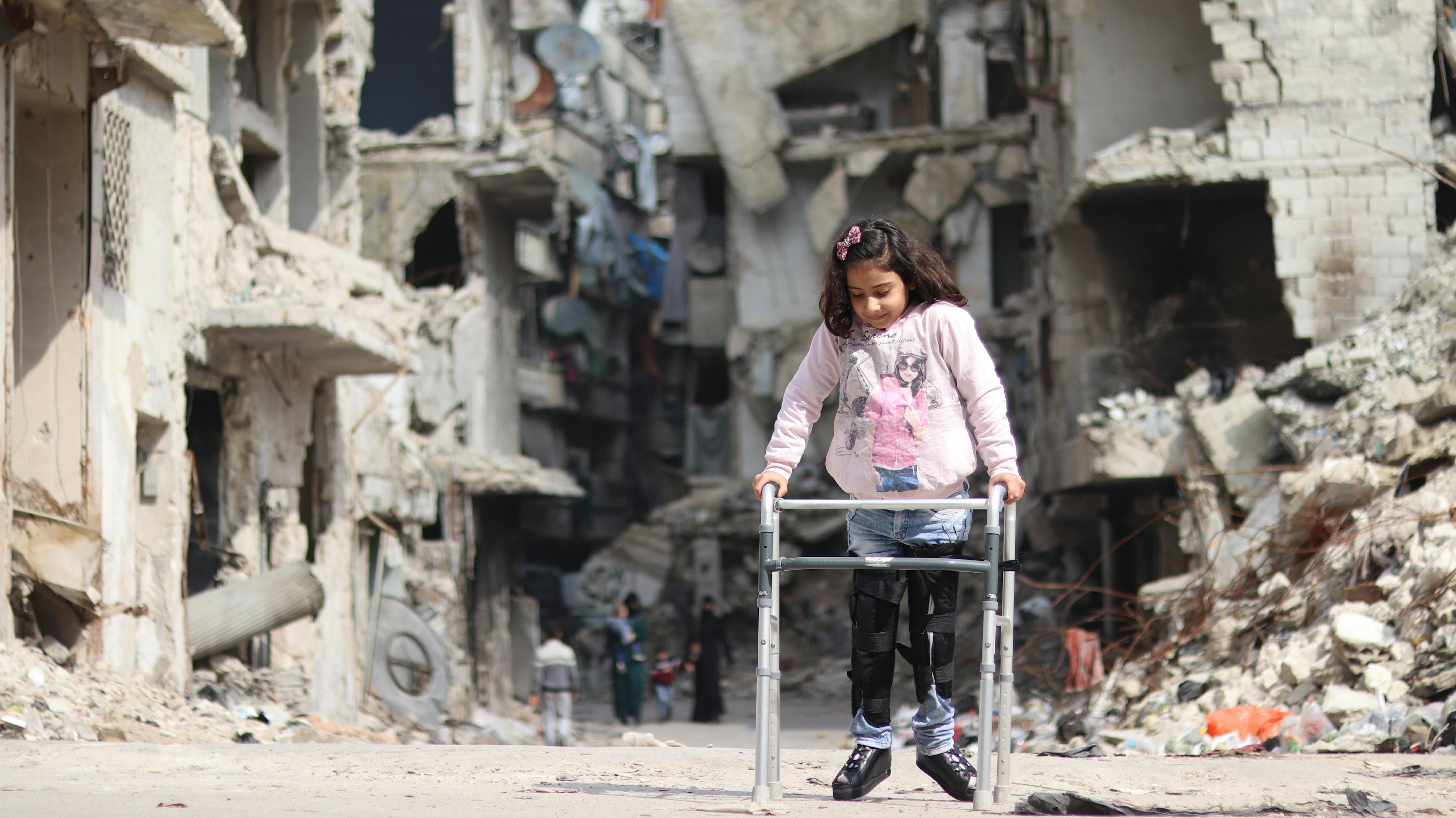 Siria - Rama 8 anni, cammina con un deambulatore nel suo quartiere nella parte orientale di Aleppo