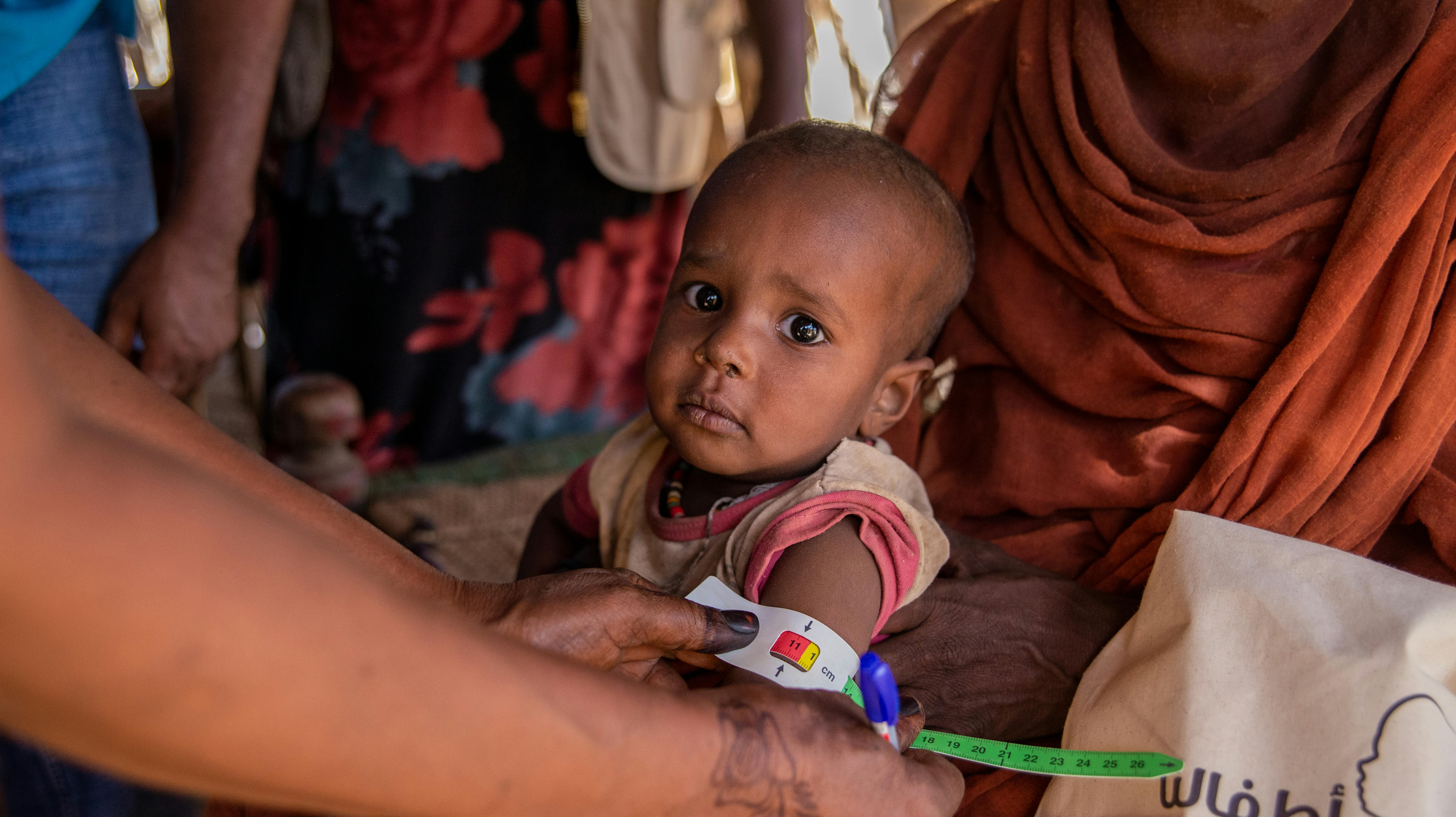 Il 2 dicembre 2024, i volontari sanitari sottopongono i bambini a screening per la malnutrizione e forniscono vitamina A e compresse antiparassitarie durante una campagna nutrizionale porta a porta sostenuta dall'UNICEF nella località di Aroma, nello stato di Kassala.