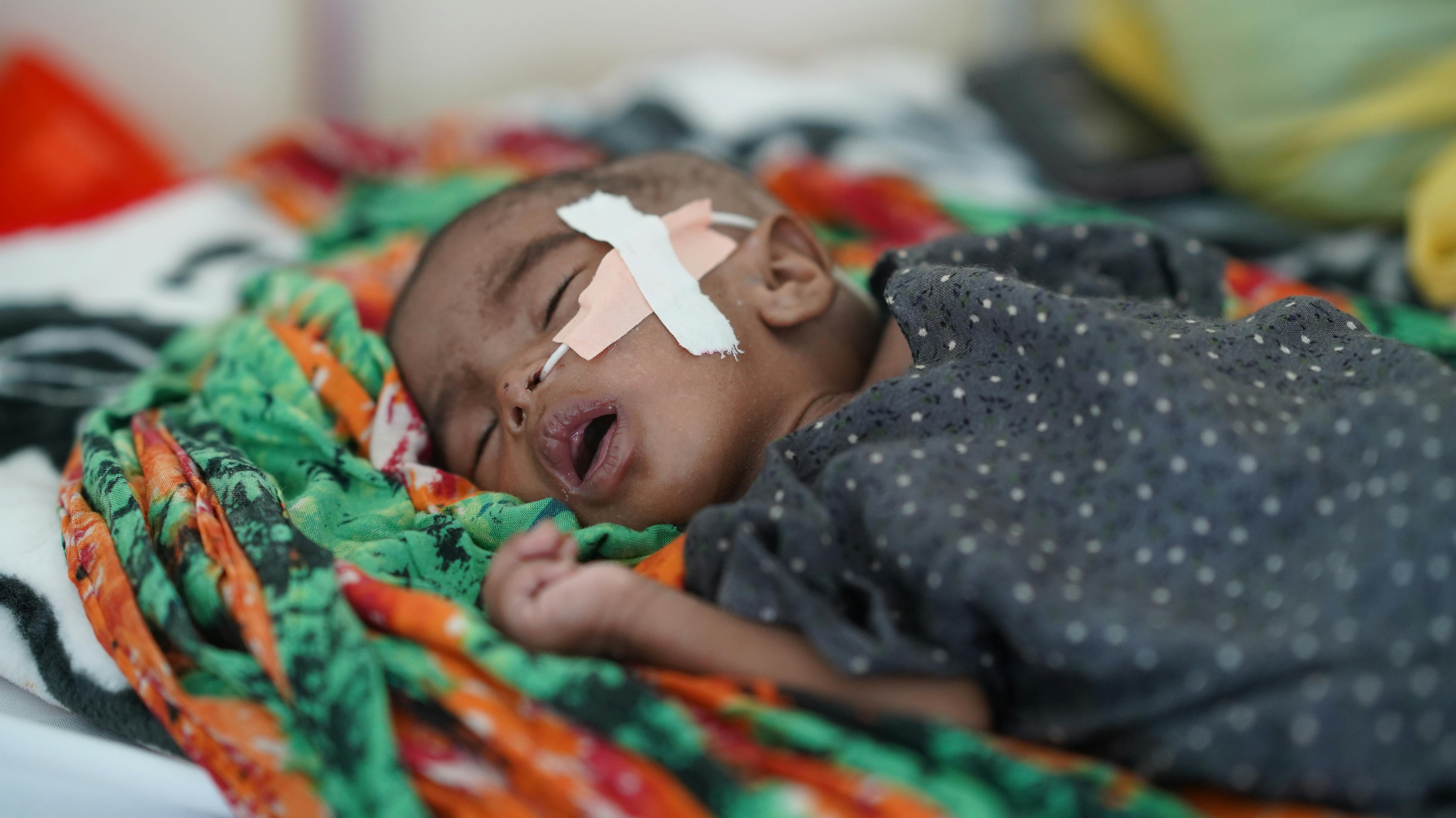 Somalia - Il Centro di Stabilizzazione Bossaso fornisce supporto salvavita a mamme e bambini.