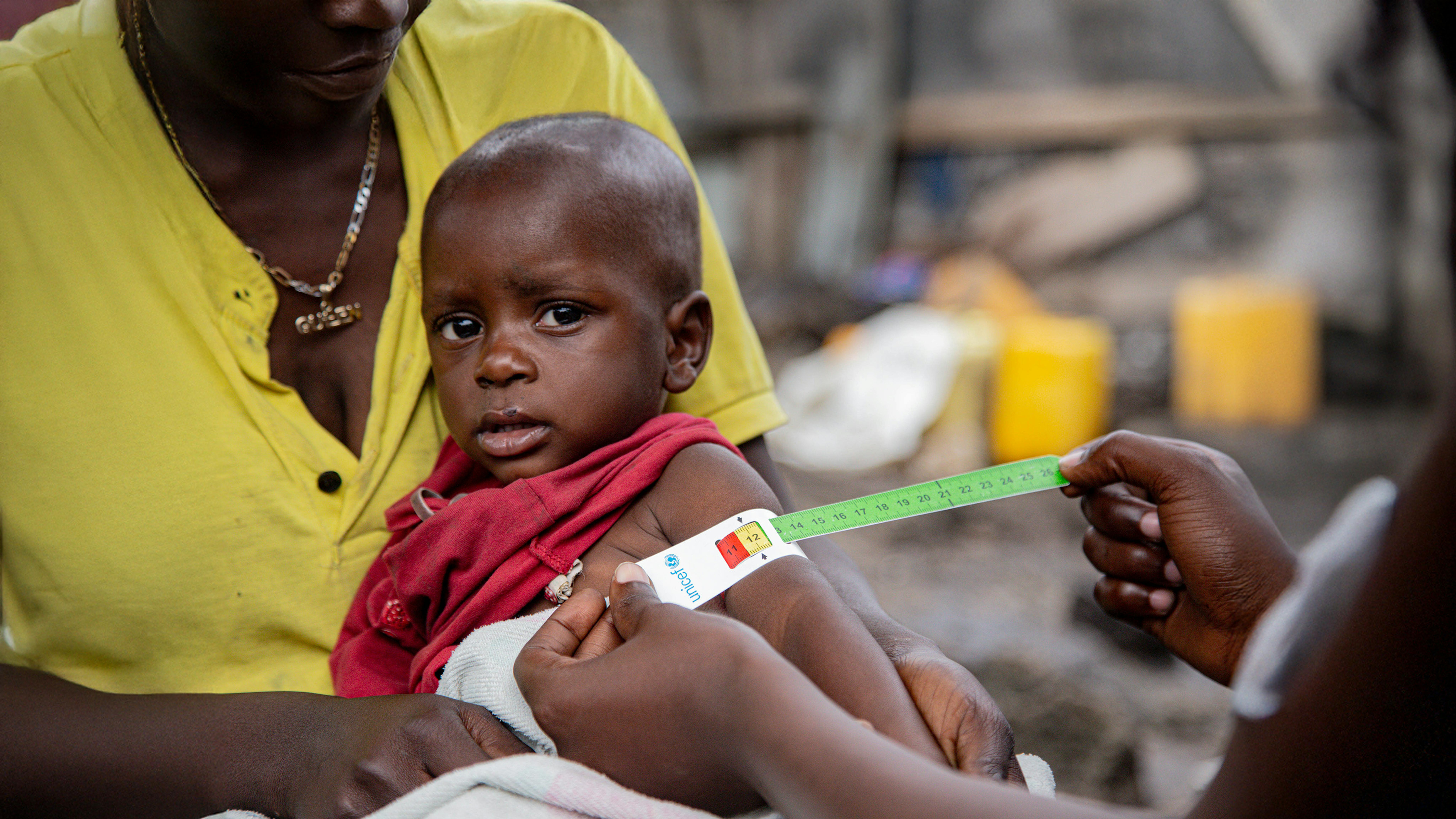 DR  Congo - Christian, 2 anni, si siede sulle ginocchia di sua madre Joseline mentre un operatore di sensibilizzazione della comunità misura il suo braccio davanti al loro rifugio a Goma, nella provincia del Nord Kivu