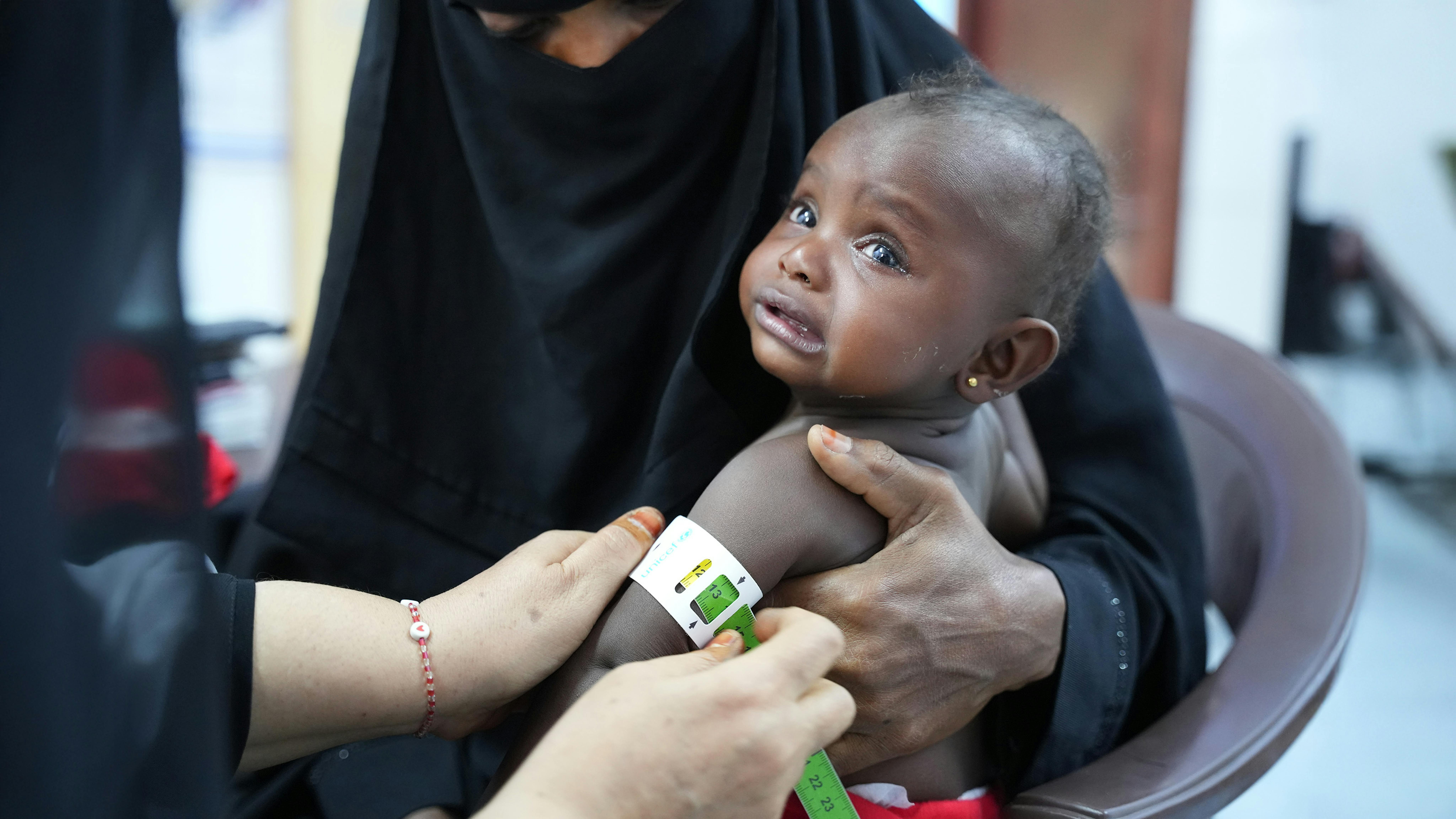Yemen - Reem Mare'i, una bambina di 20 mesi, si sottopone a screening per la malnutrizione presso il PHC di Dar Sad Health Compound ad Aden,