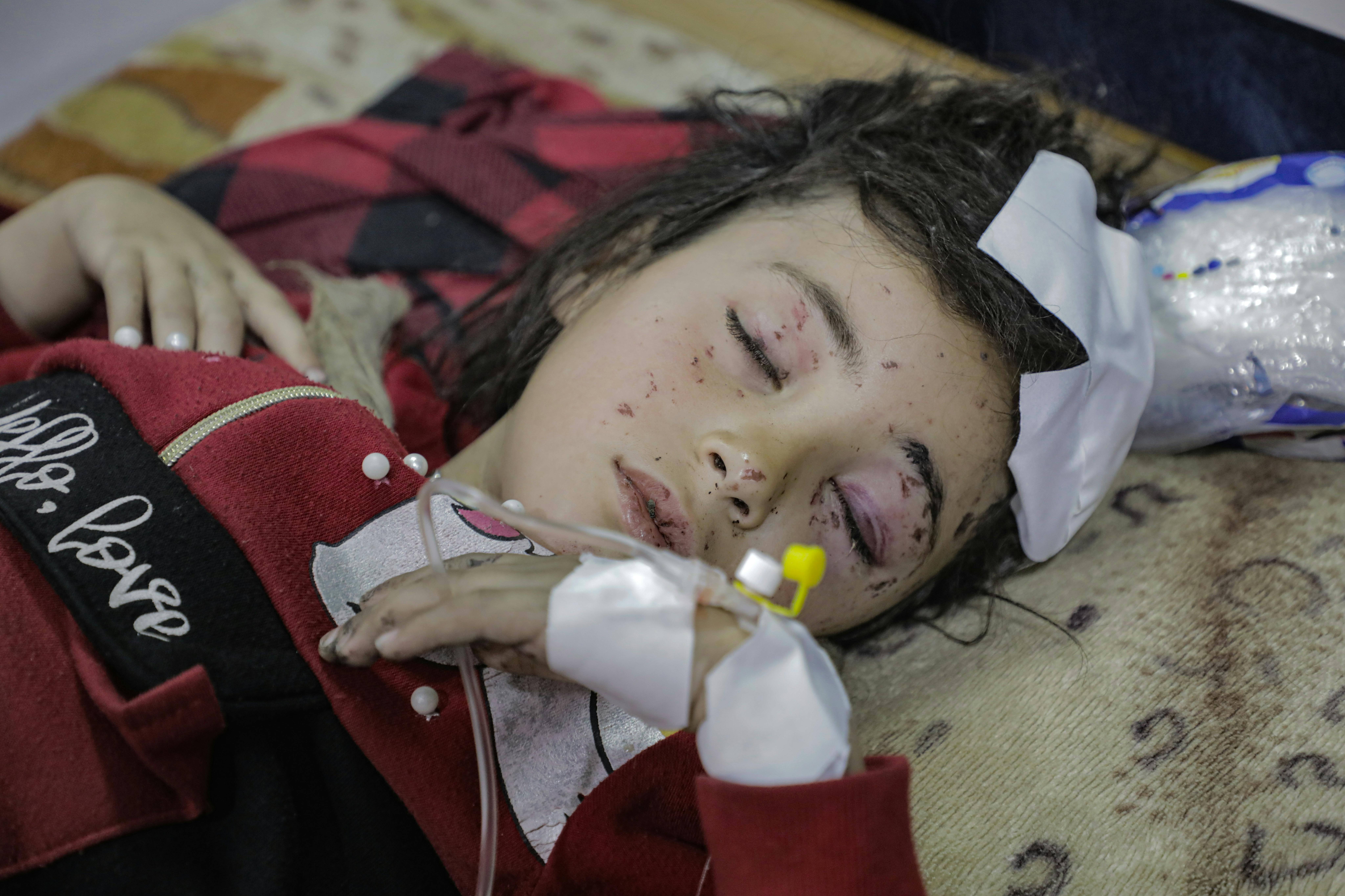 Judy Al-Banna, 8 anni, giace in un letto d'ospedale a Gaza City dopo aver riportato ferite potenzialmente letali.