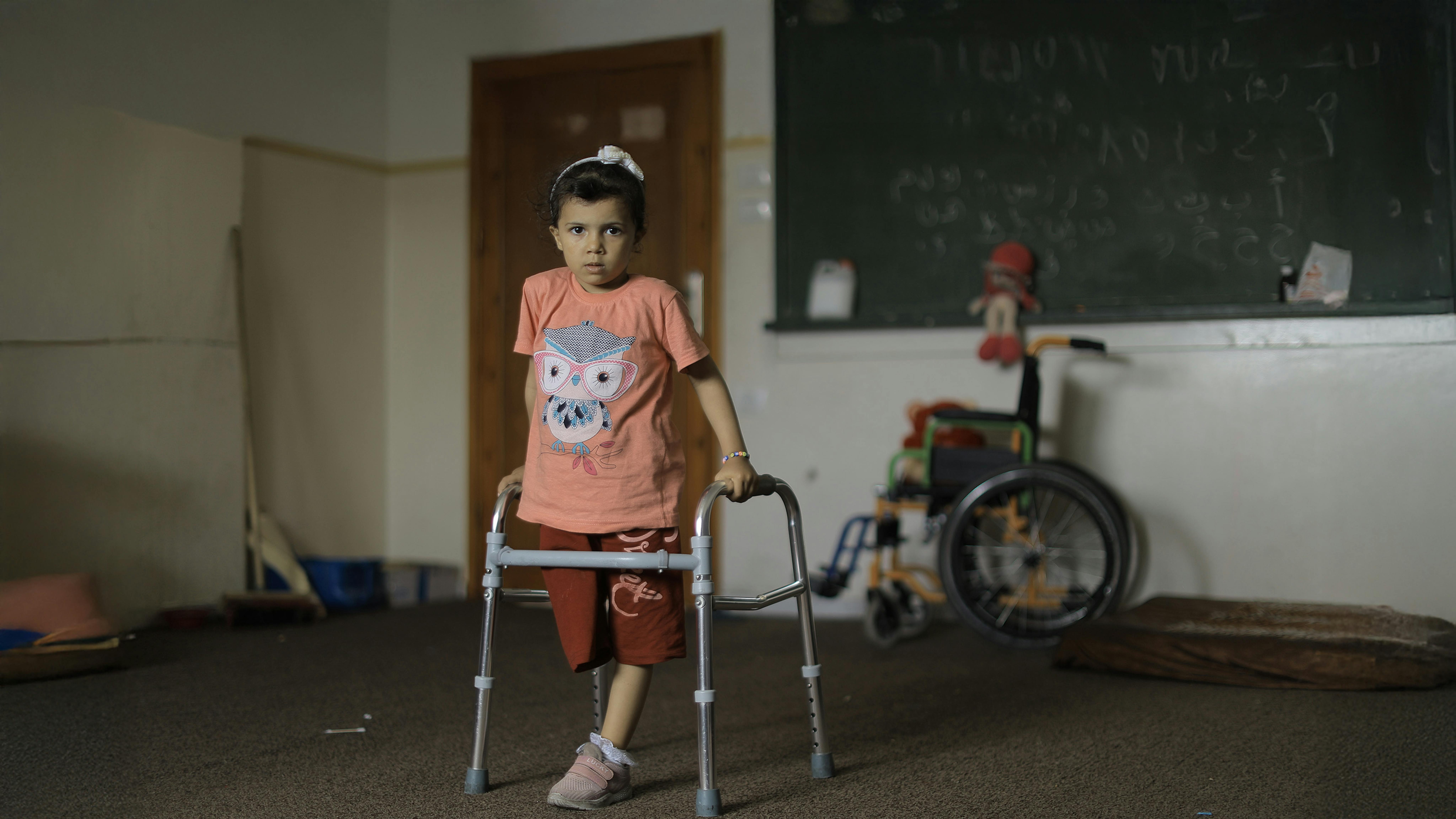Stato di Palestina - Sila, 4 anni, ha perso la gamba destra dopo che la sua casa è stata bombardata a Gaza City, ha perso anche sua madre, suo padre e le sue tre sorelle, Saba, Farah e Laila