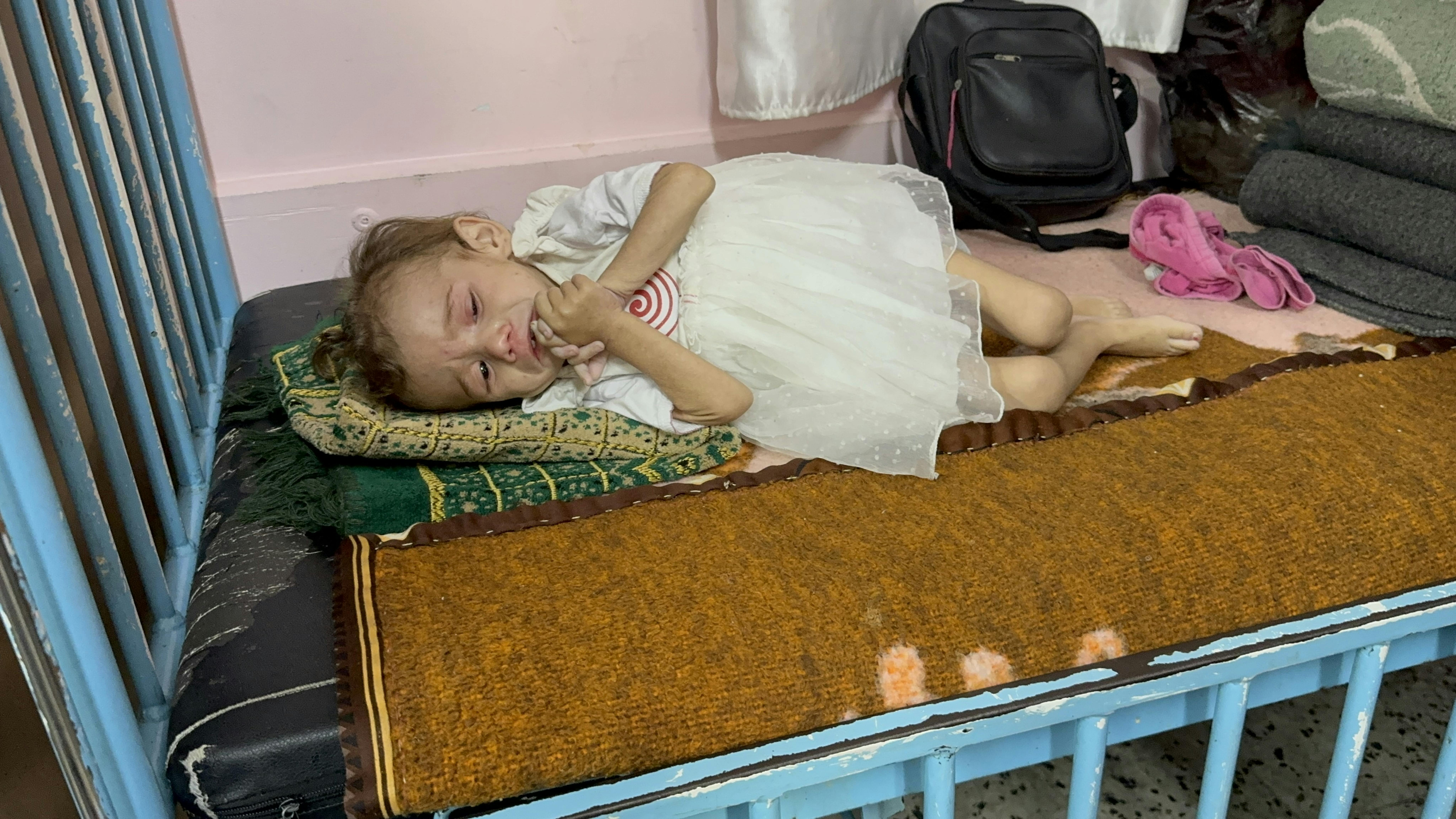 Striscia di Gaza - Mariam, 2 anni, giace su un letto dell'ospedale Nasser di Khan Younis, nella Striscia di Gaza. Mariam soffre di malnutrizione acuta. Pesa solo 5 chilogrammi