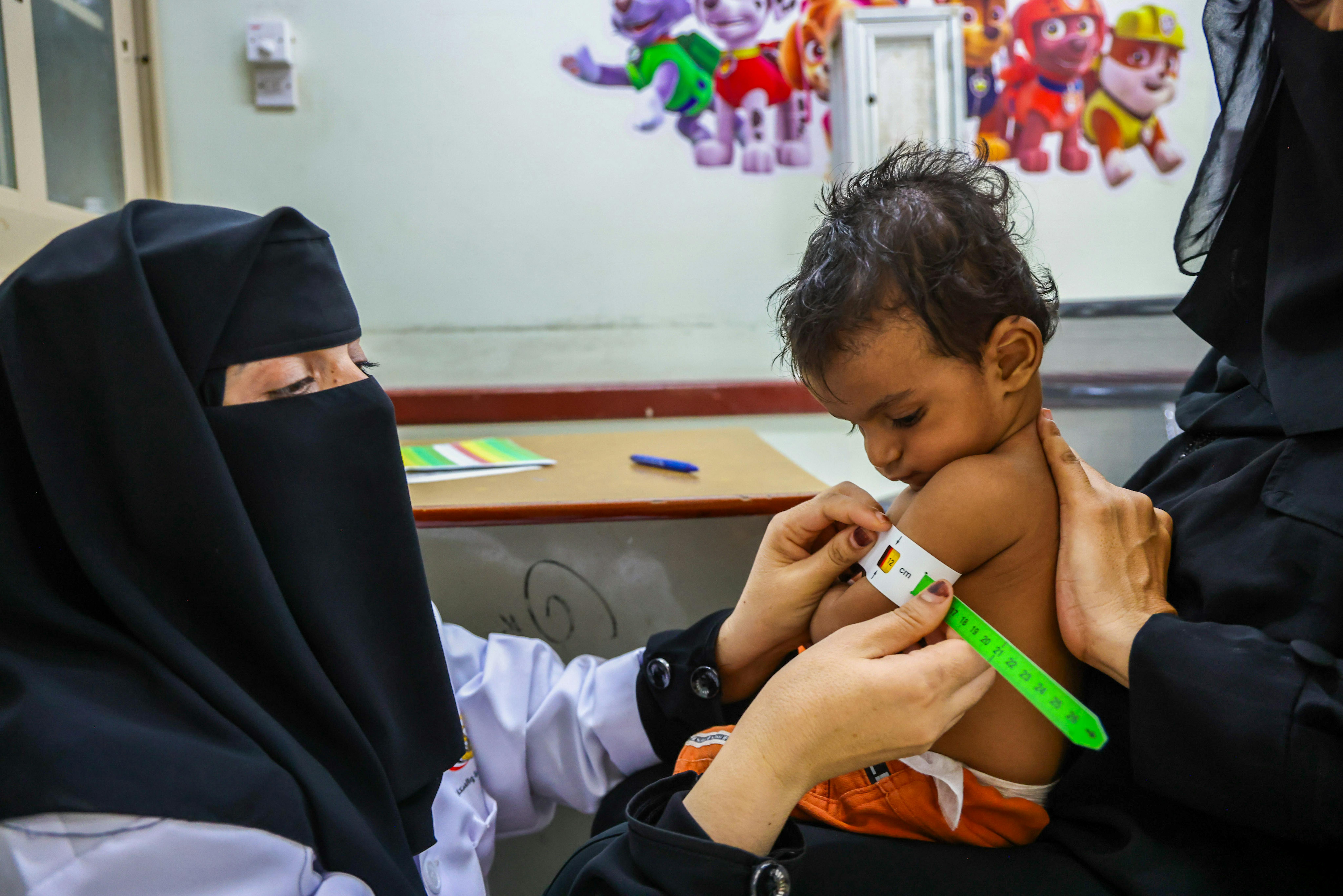 Yemen: L'infermiera Intisar Hassan prende le recenti misurazioni MUAC di Hamad dopo il trattamento, Taizz, luglio 2025.