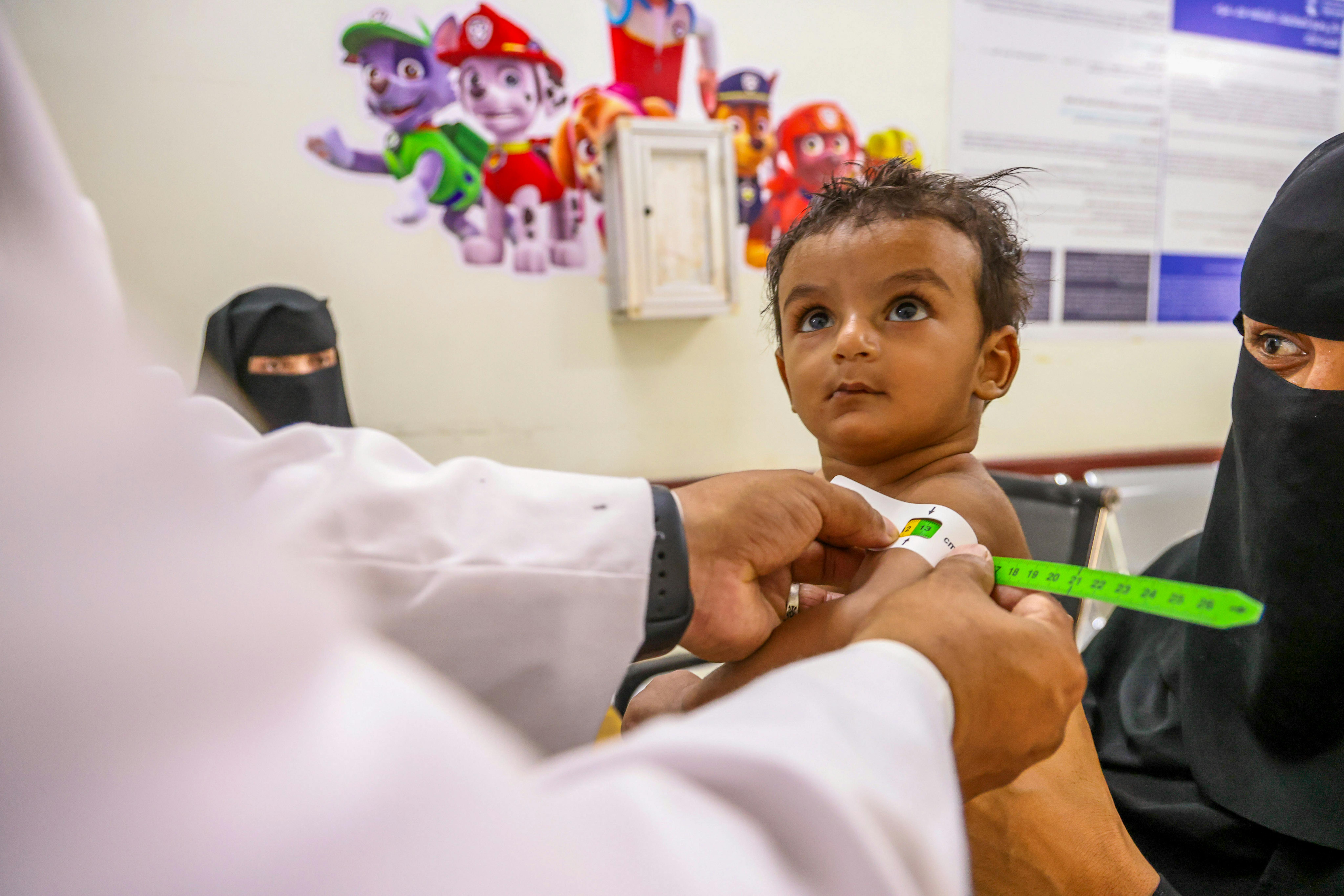 Il Dottor Abdulsalam usa il MUAC per monitorare le condizioni del piccolo Hamed, 9 mesi, dopo le dimissioni dal Centro di Trattamento Nutrizionale di Taizz, Yemen