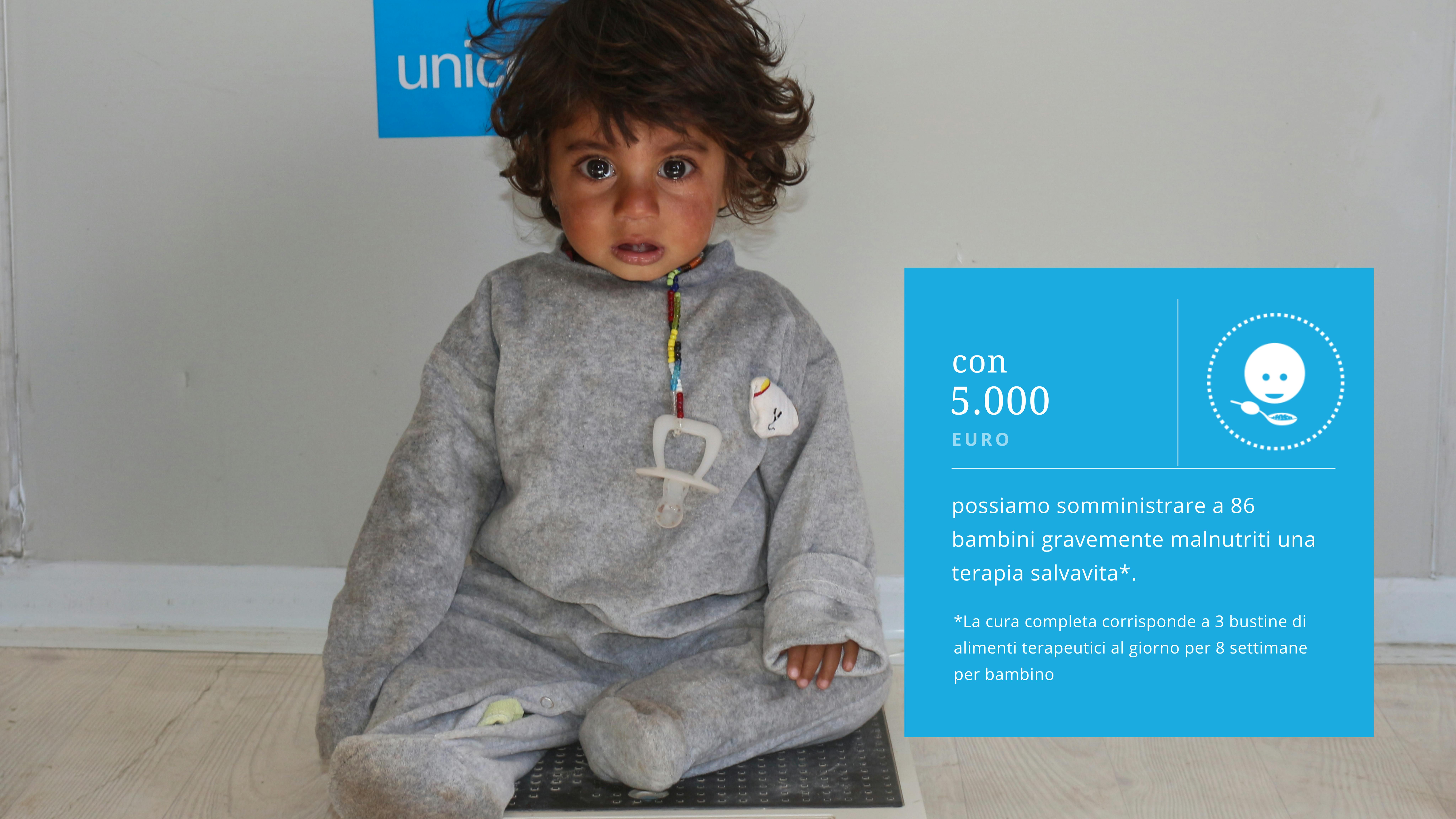 Siria: Mahmoud, 14 mesi, vive nel campo profughi di Al-Hol. Sta indossando un braccialetto speciale MUAC, che serve per determinare il grado di malnutrizione dei bambini