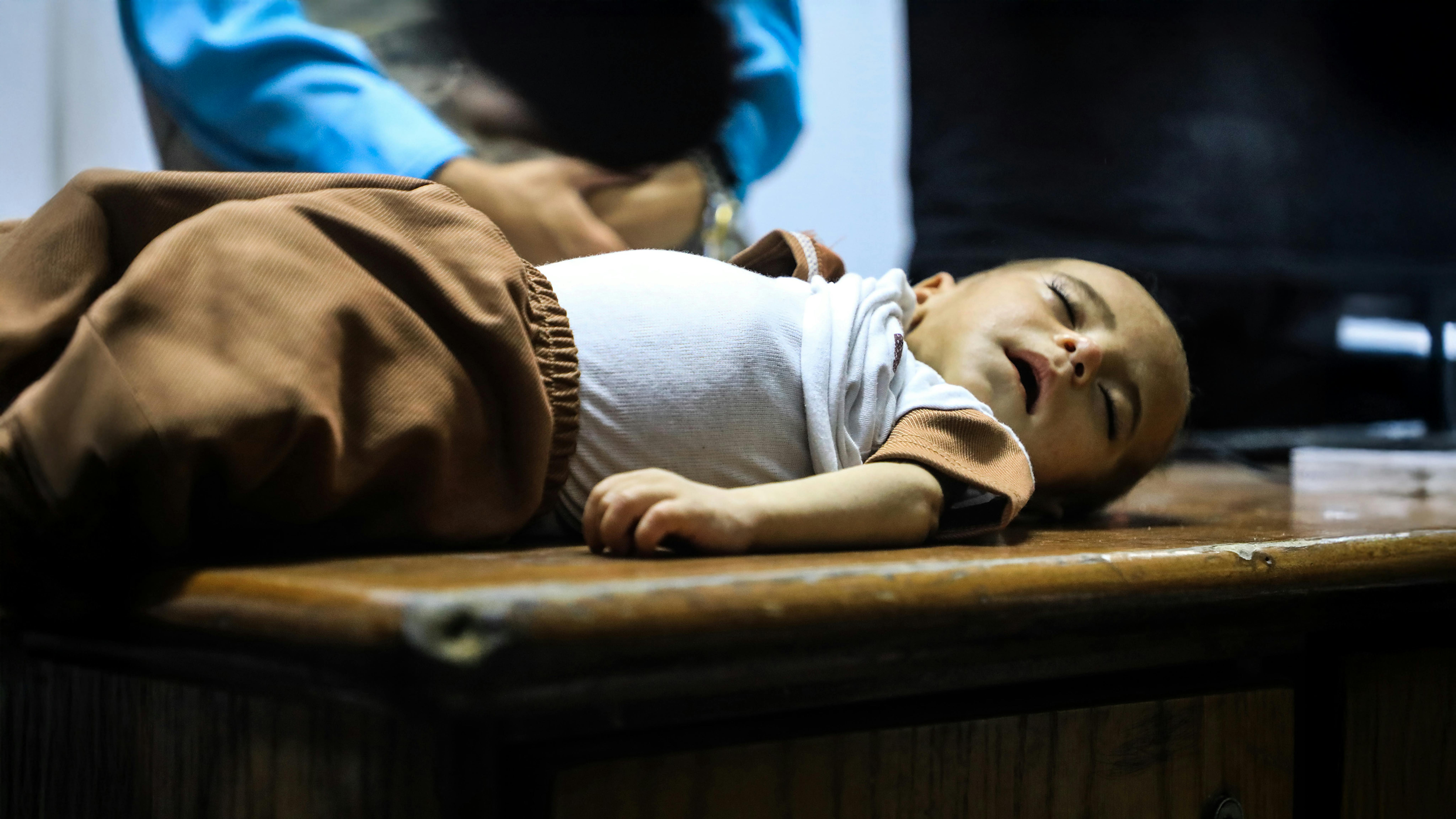 Un bambino dorme nel punto di trattamento della malnutrizione dell'ospedale Friends of the Patient Society a Gaza City