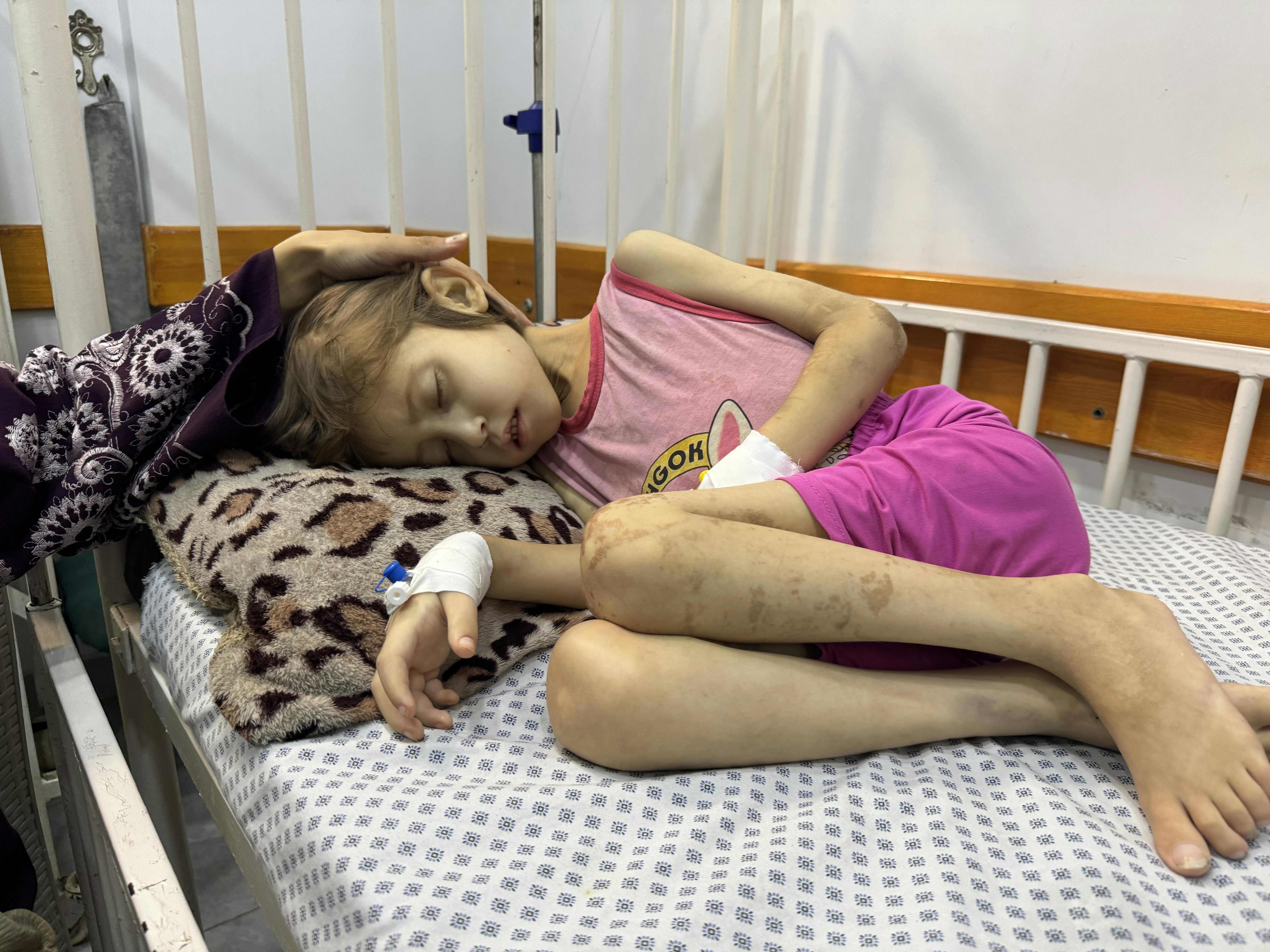 Jana, di 9 anni, era ricoverata all'ospedale “Friends of the Patient Society” di Gaza City. Purtroppo non è riuscita a sopravvivere