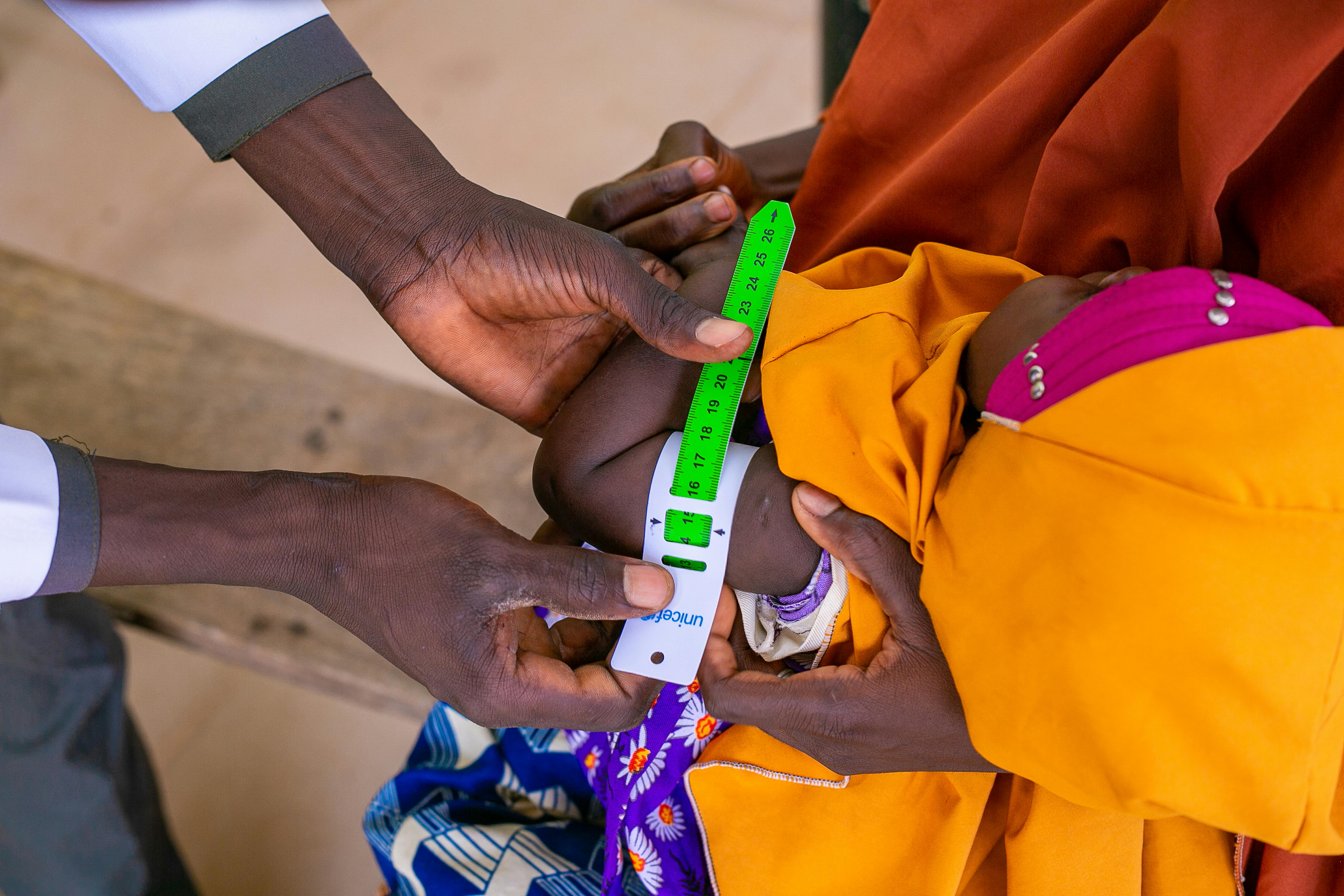 Nigeria, un bambino viene visitata da un operatore sanitario utilizzando il nastro MUAC