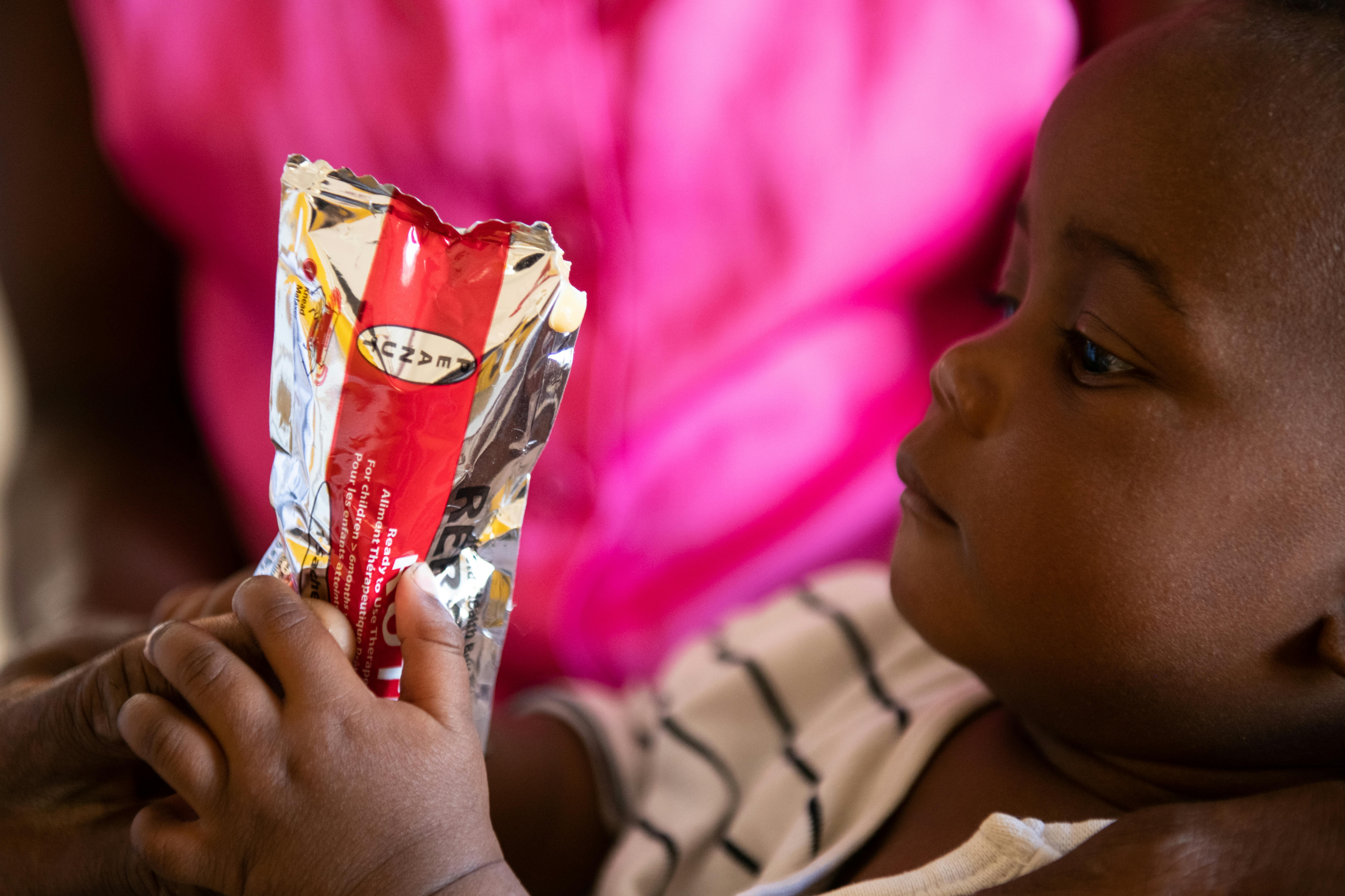 Lauren Matiki, 6 mesi, tiene in mano una bustina di RUTF al Madalitso Nutrition and Rehabilitation Centre di Mangochi, nel sud del Malawi