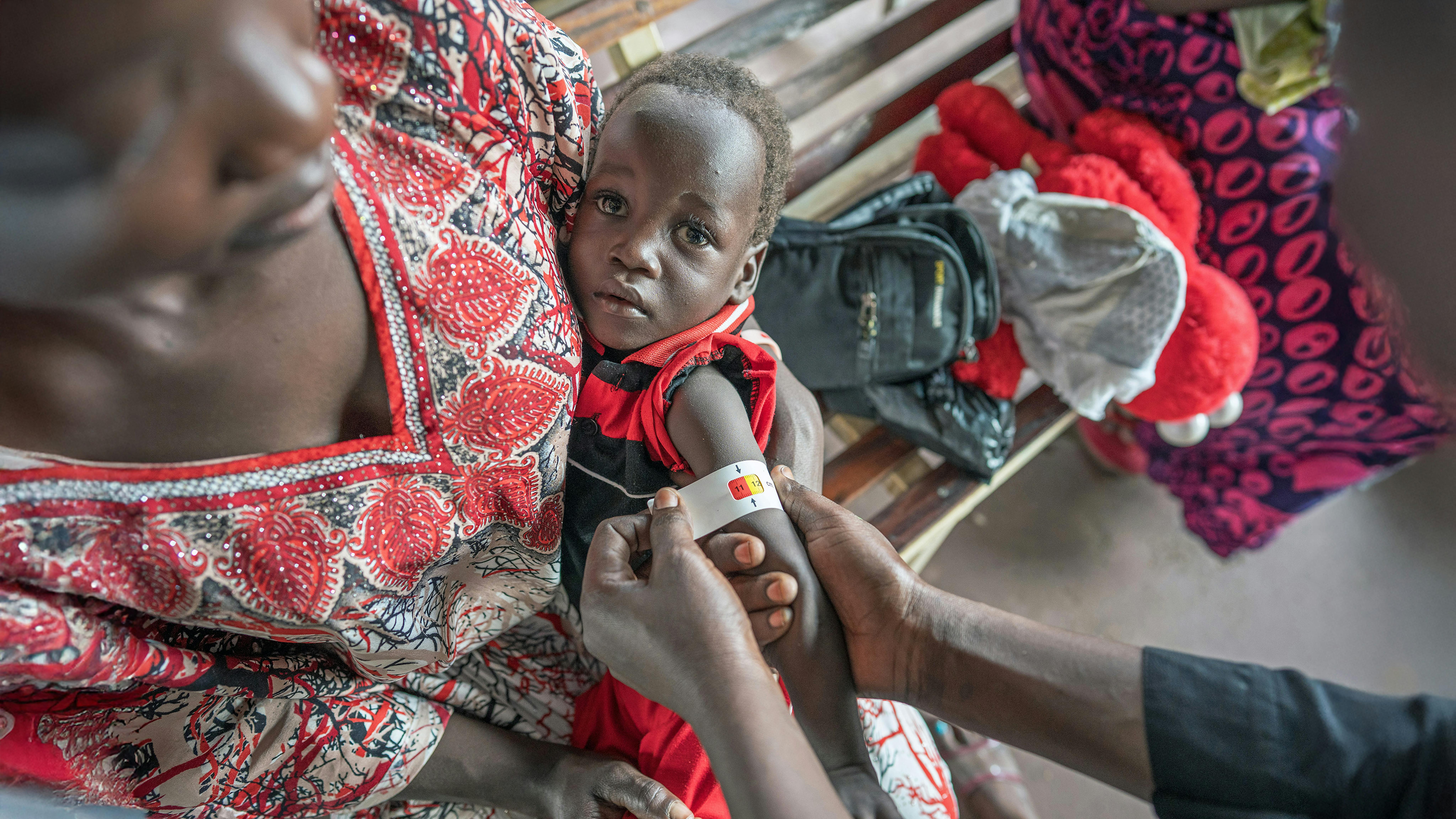 Un bambino viene sottoposto a un controllo per malnutrizione presso la clinica nutrizionale supportata dall'UNICEF presso il Kimu Primary Healthcare Centre di Juba, in Sud Sudan.