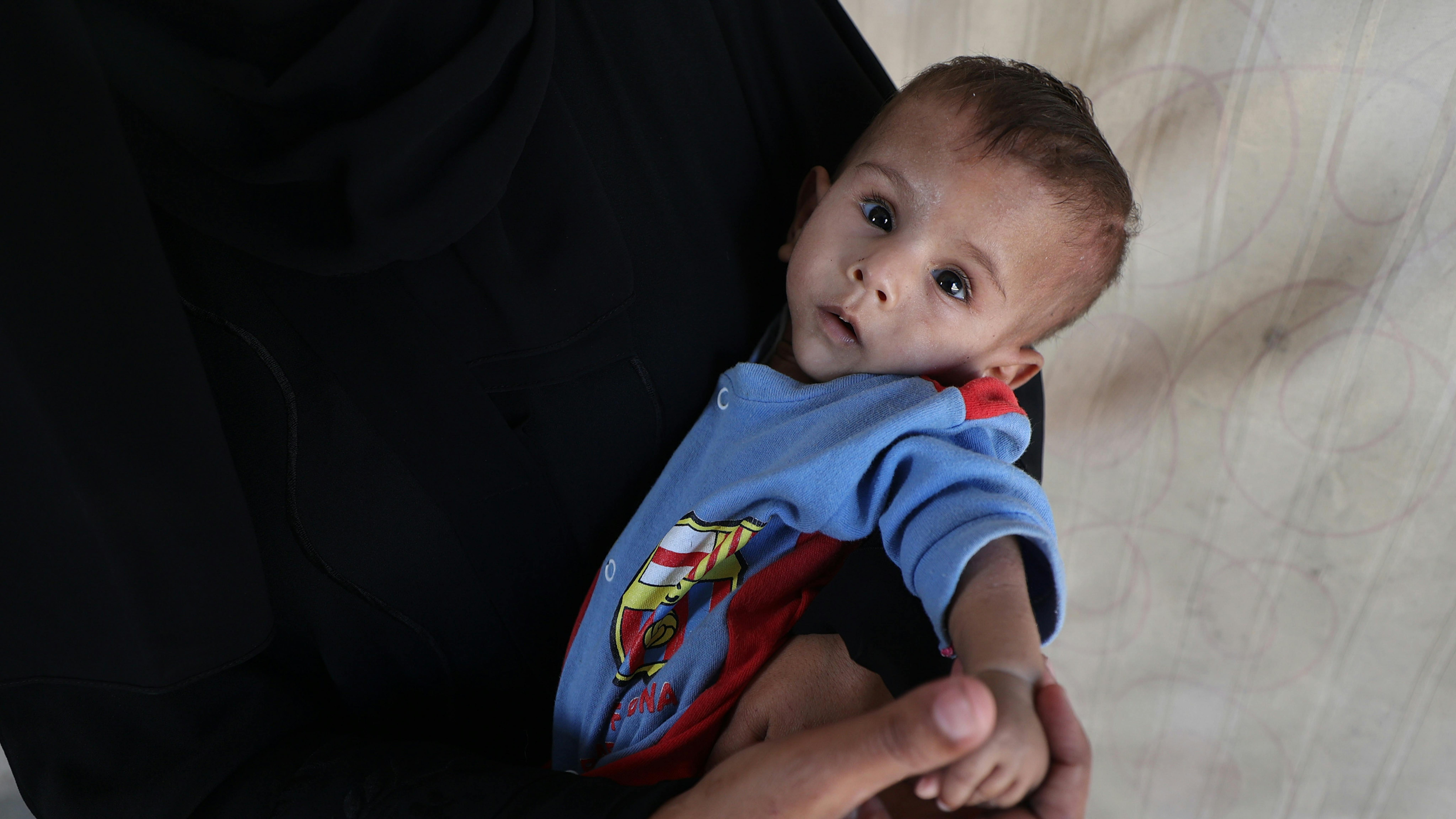 Gaza -  Eitemad tiene suo figlio Ali nella loro tenda improvvisata ad Al-Mawasi, nella Striscia di Gaza. Ali, di due anni, soffre di malnutrizione e ritardo di crescita