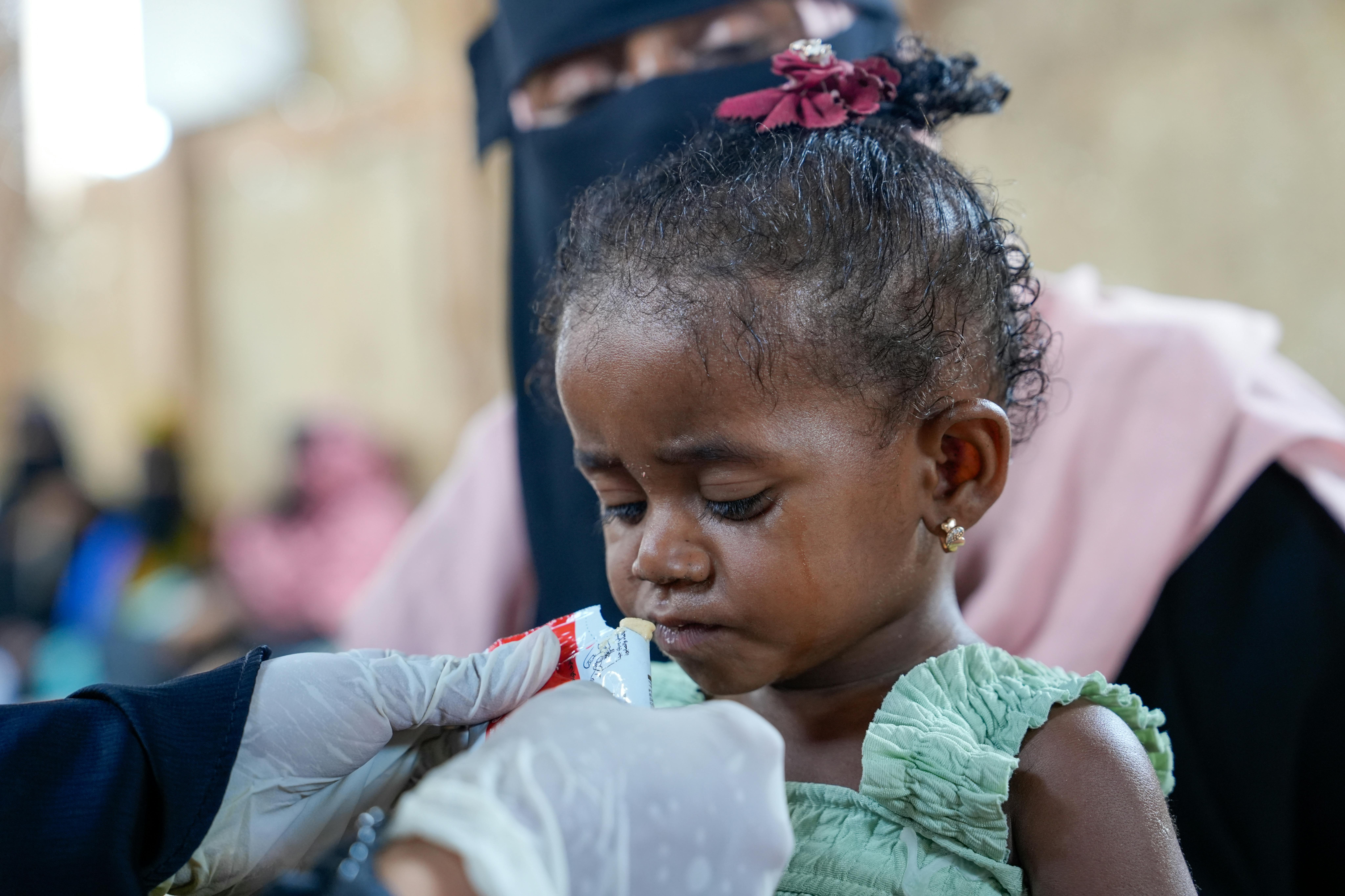 Yemen - Rana, di 18 mesi, riceve con entusiasmo gli alimenti terapeutici pronti all’uso (RUTF), fondamentali per la sua sopravvivenza, da un medico nel campo profughi di Al-Atira, a Lahj