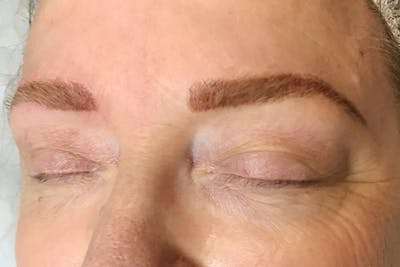 3D Microblading/ Henna Brows Before & After Gallery - Patient 11676258 - Image 2