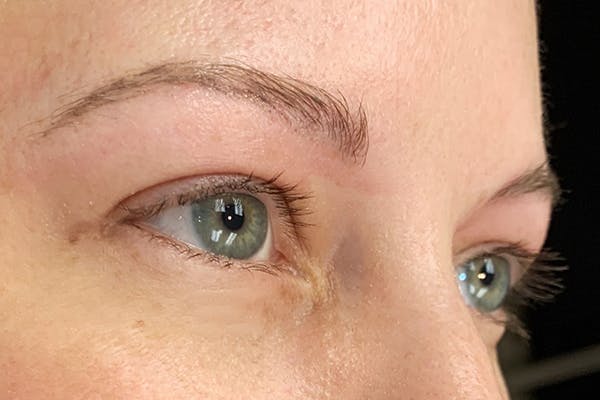 3D Microblading/ Henna Brows Before & After Gallery - Patient 11676259 - Image 1