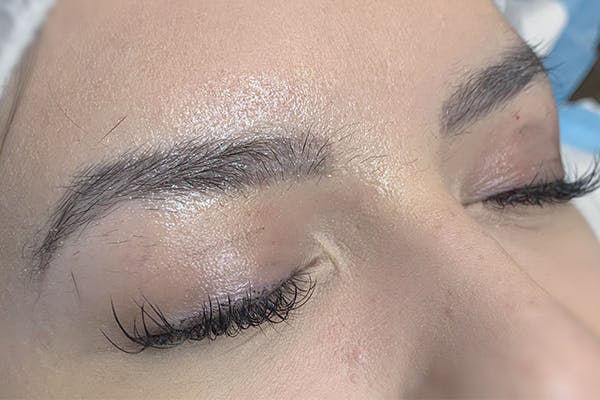 3D Microblading/ Henna Brows Gallery - Patient 11676260 - Image 1
