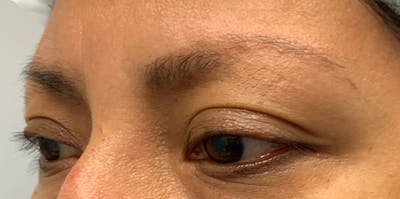 3D Microblading/ Henna Brows Before & After Gallery - Patient 11676264 - Image 1
