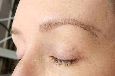 3D Microblading/ Henna Brows Before & After Gallery - Patient 11676267 - Image 1