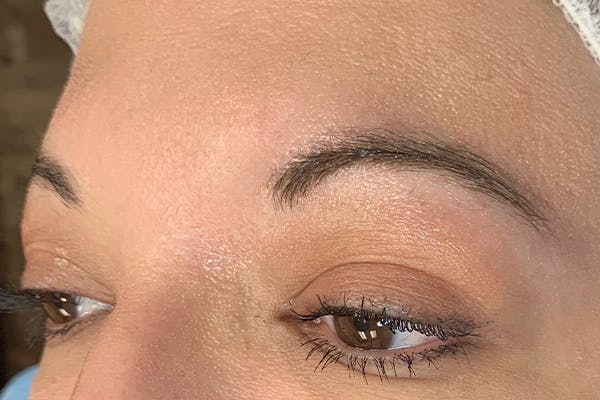 3D Microblading/ Henna Brows Before & After Gallery - Patient 11676268 - Image 1