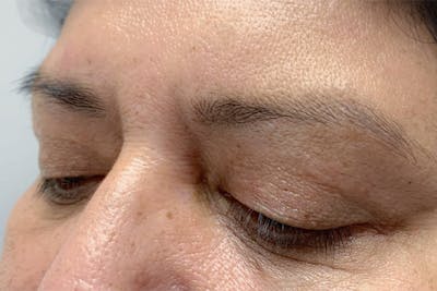 3D Microblading/ Henna Brows Gallery - Patient 11676270 - Image 1