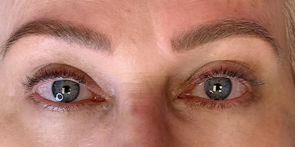 3D Microblading/ Henna Brows Before & After Gallery - Patient 11676271 - Image 2