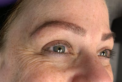 3D Microblading/ Henna Brows Before & After Gallery - Patient 11676272 - Image 2