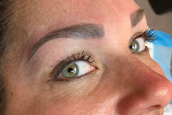 3D Microblading/ Henna Brows Before & After Gallery - Patient 11676273 - Image 2