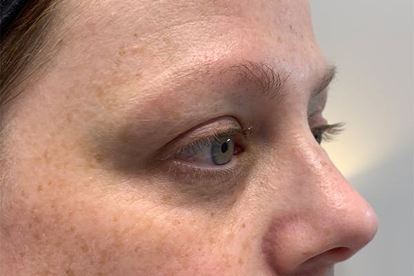 3D Microblading/ Henna Brows Before & After Gallery - Patient 55482785 - Image 1