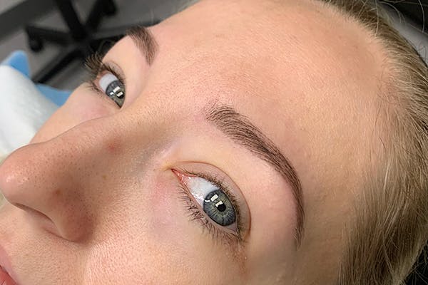 3D Microblading/ Henna Brows Before & After Gallery - Patient 55482784 - Image 2