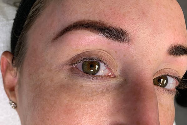 3D Microblading/ Henna Brows Before & After Gallery - Patient 55482783 - Image 2