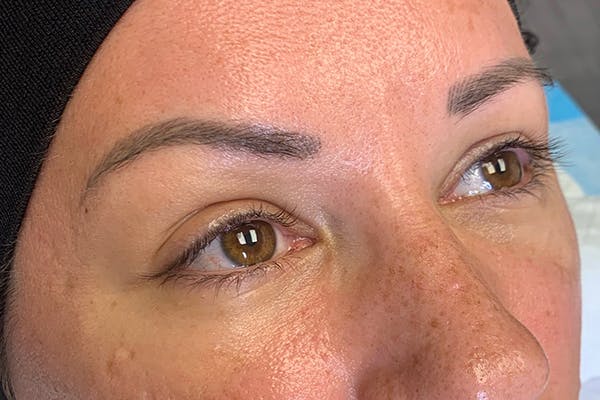 3D Microblading/ Henna Brows Gallery - Patient 55482780 - Image 1