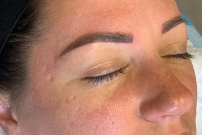 3D Microblading/ Henna Brows Before & After Gallery - Patient 55482780 - Image 2