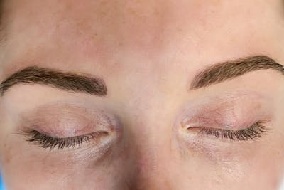 3D Microblading/ Henna Brows Before & After Gallery - Patient 55482779 - Image 2