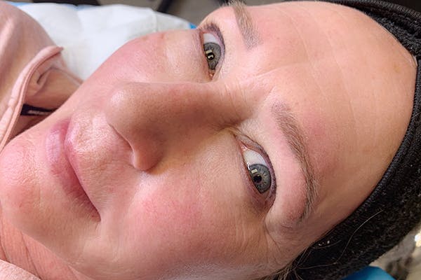 Permanent Makeup Before & After Gallery - Patient 55482885 - Image 2