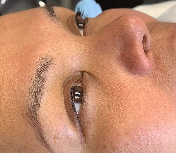 Permanent Makeup Before & After Gallery - Patient 57578641 - Image 1