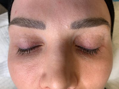 Permanent Makeup Before & After Gallery - Patient 57578643 - Image 1