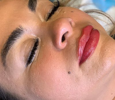 Permanent Makeup Before & After Gallery - Patient 64195239 - Image 2