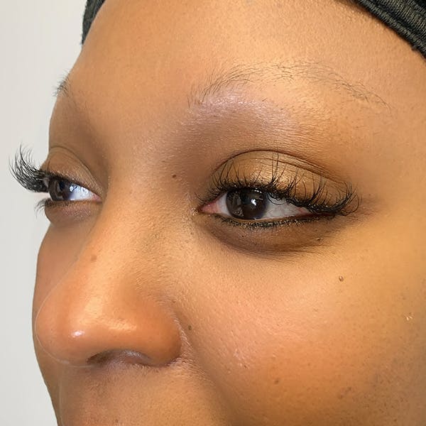 3D Microblading/ Henna Brows Gallery - Patient 67096464 - Image 1
