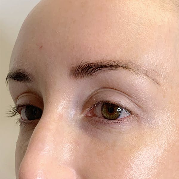 3D Microblading/ Henna Brows Gallery - Patient 67096465 - Image 1